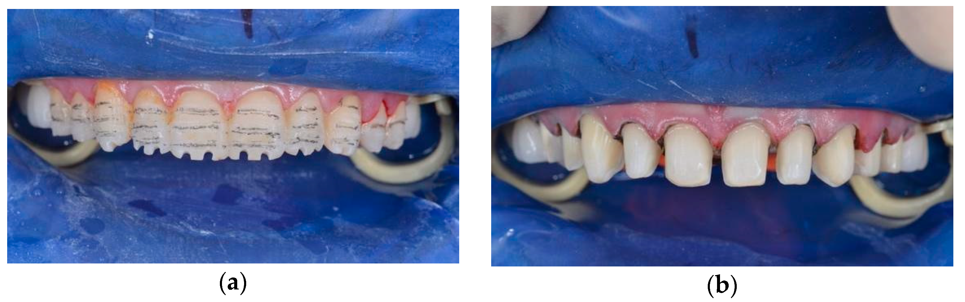 Ijerph 19 01474 g011