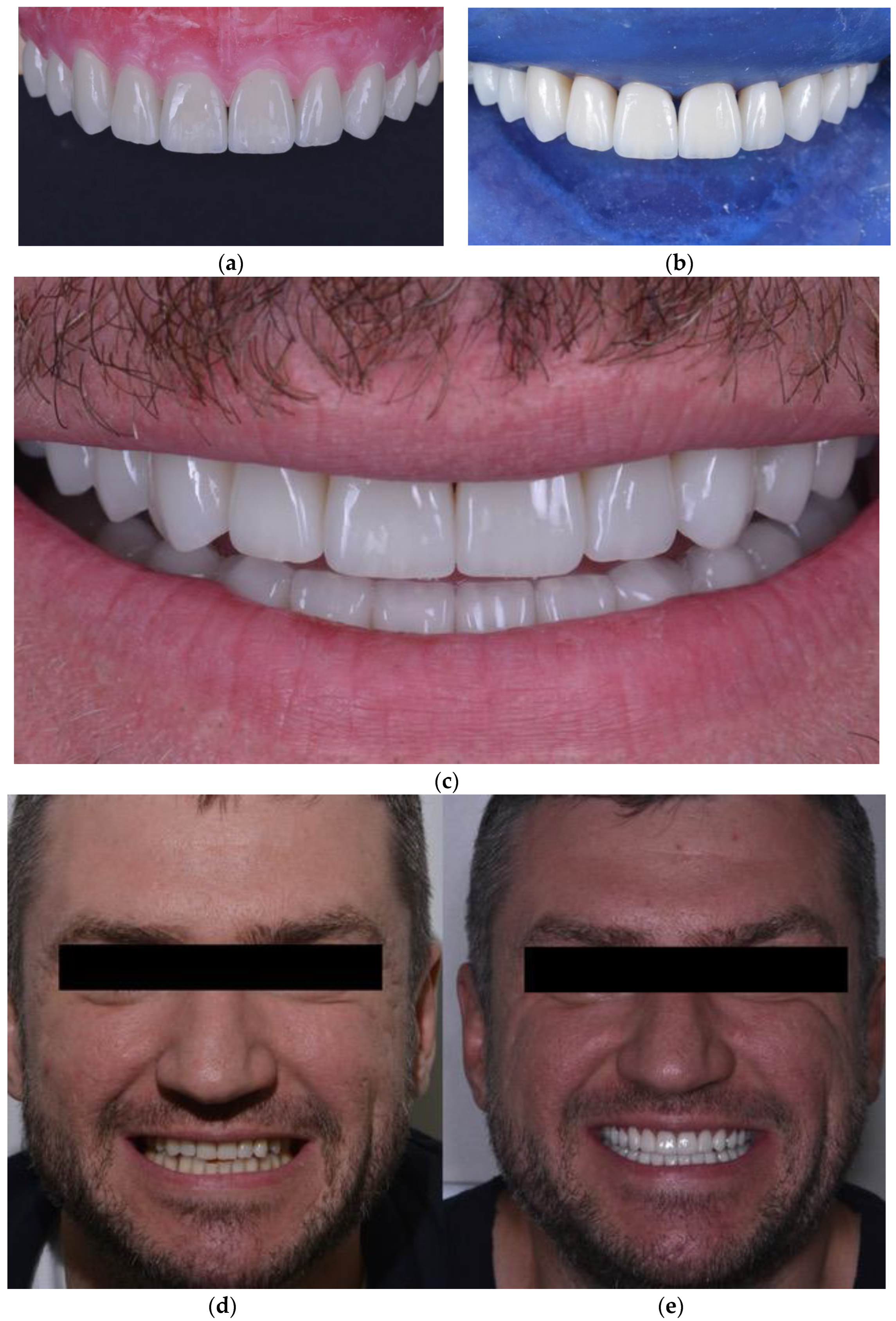 Ijerph 19 01474 g012