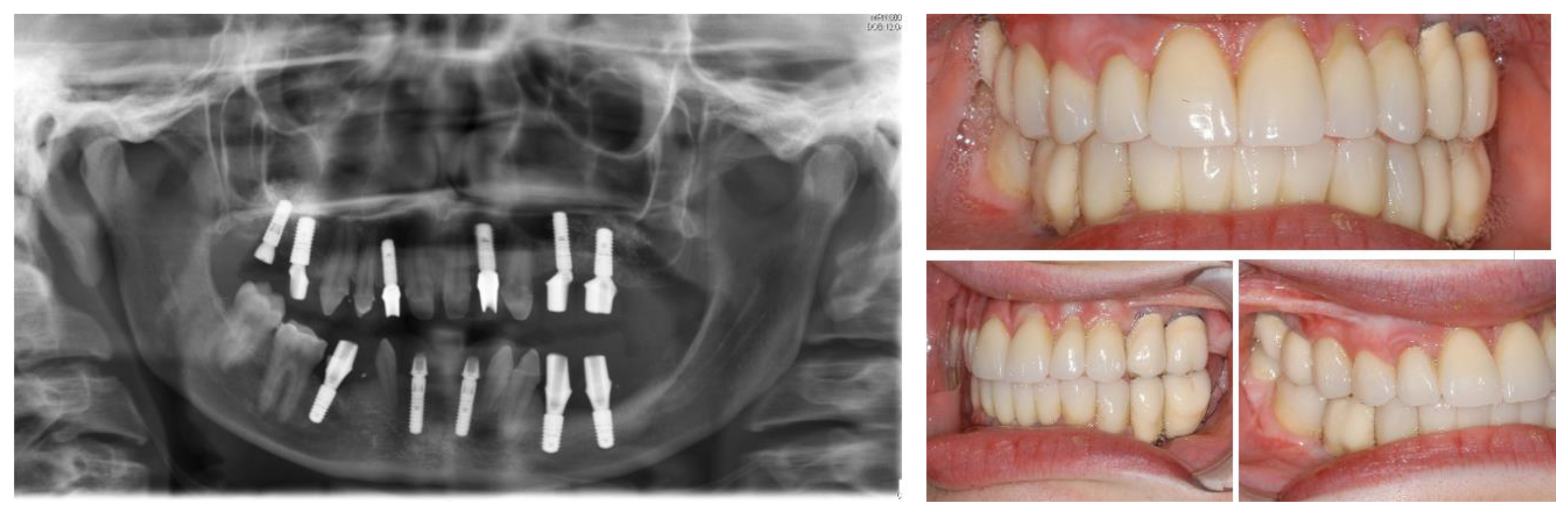 Ijerph 19 01489 g005