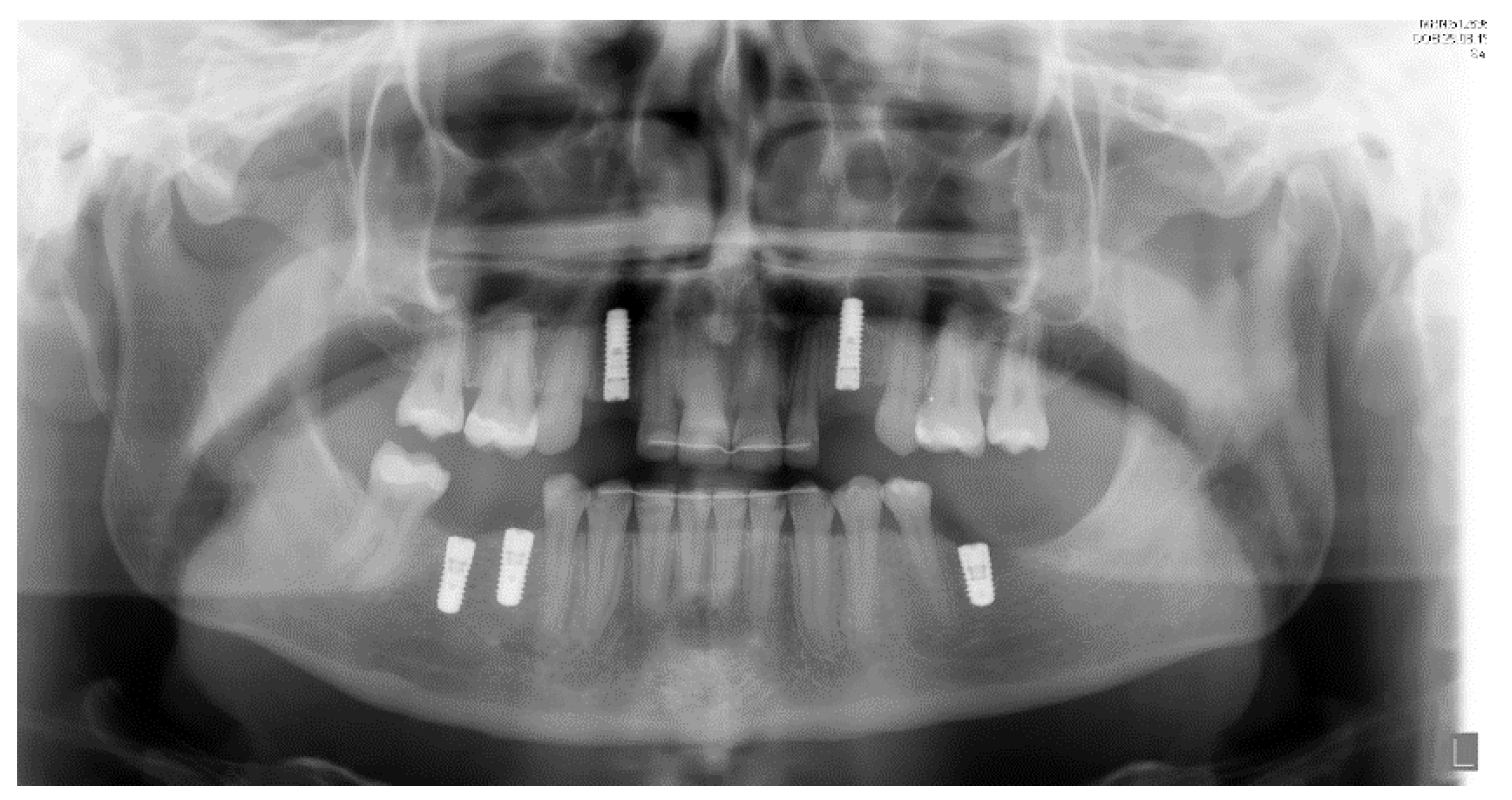 Ijerph 19 01489 g010