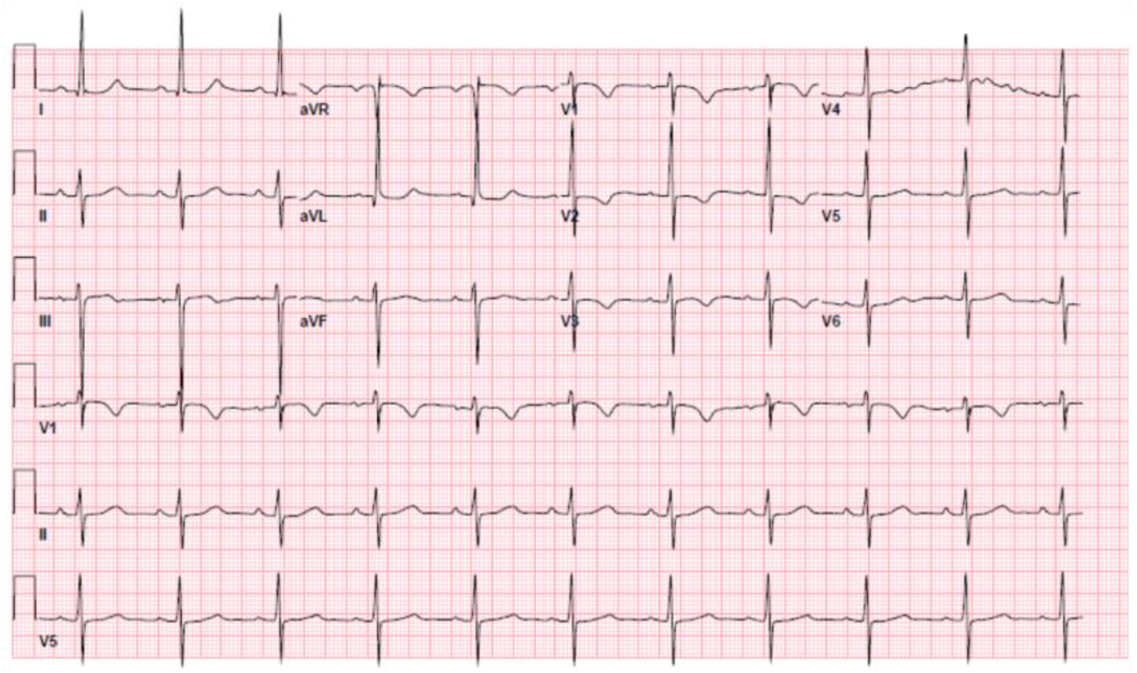 Ijerph 19 01554 g001