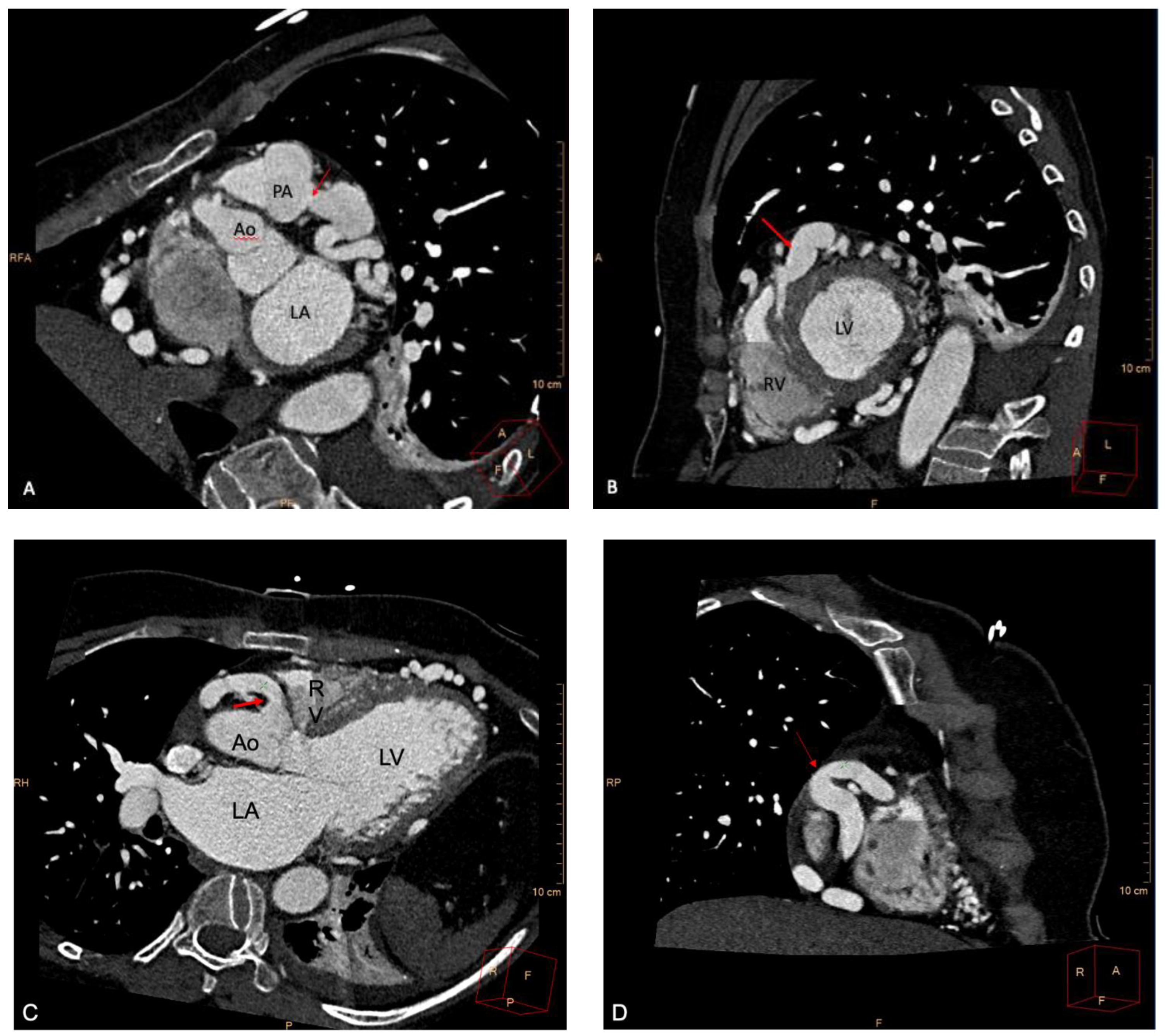 Ijerph 19 01554 g002
