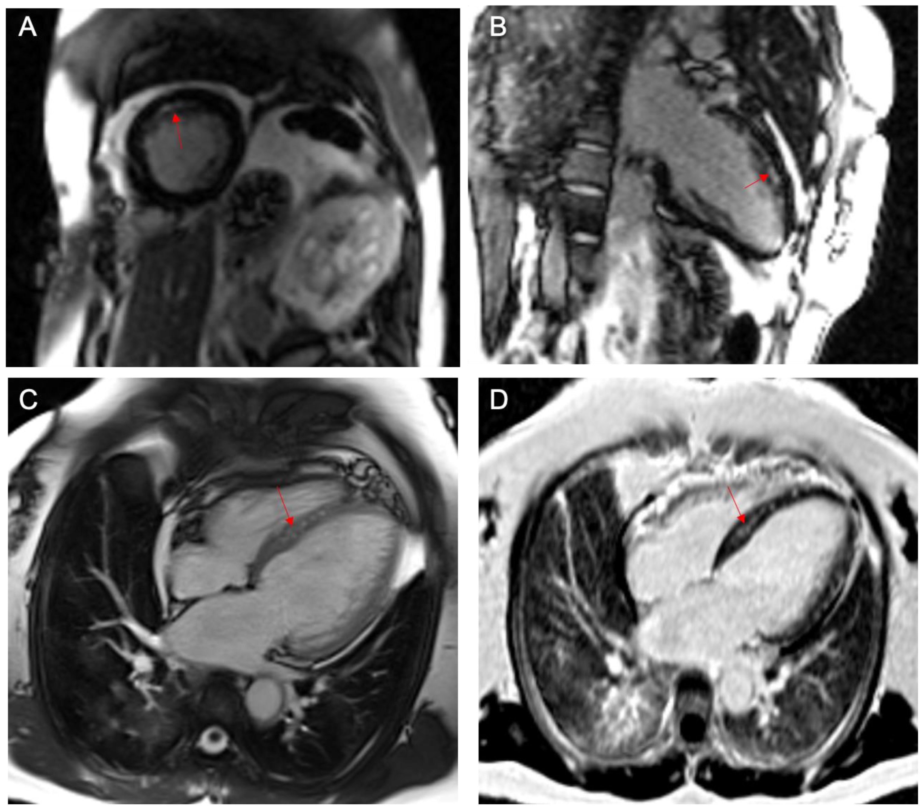 Ijerph 19 01554 g003