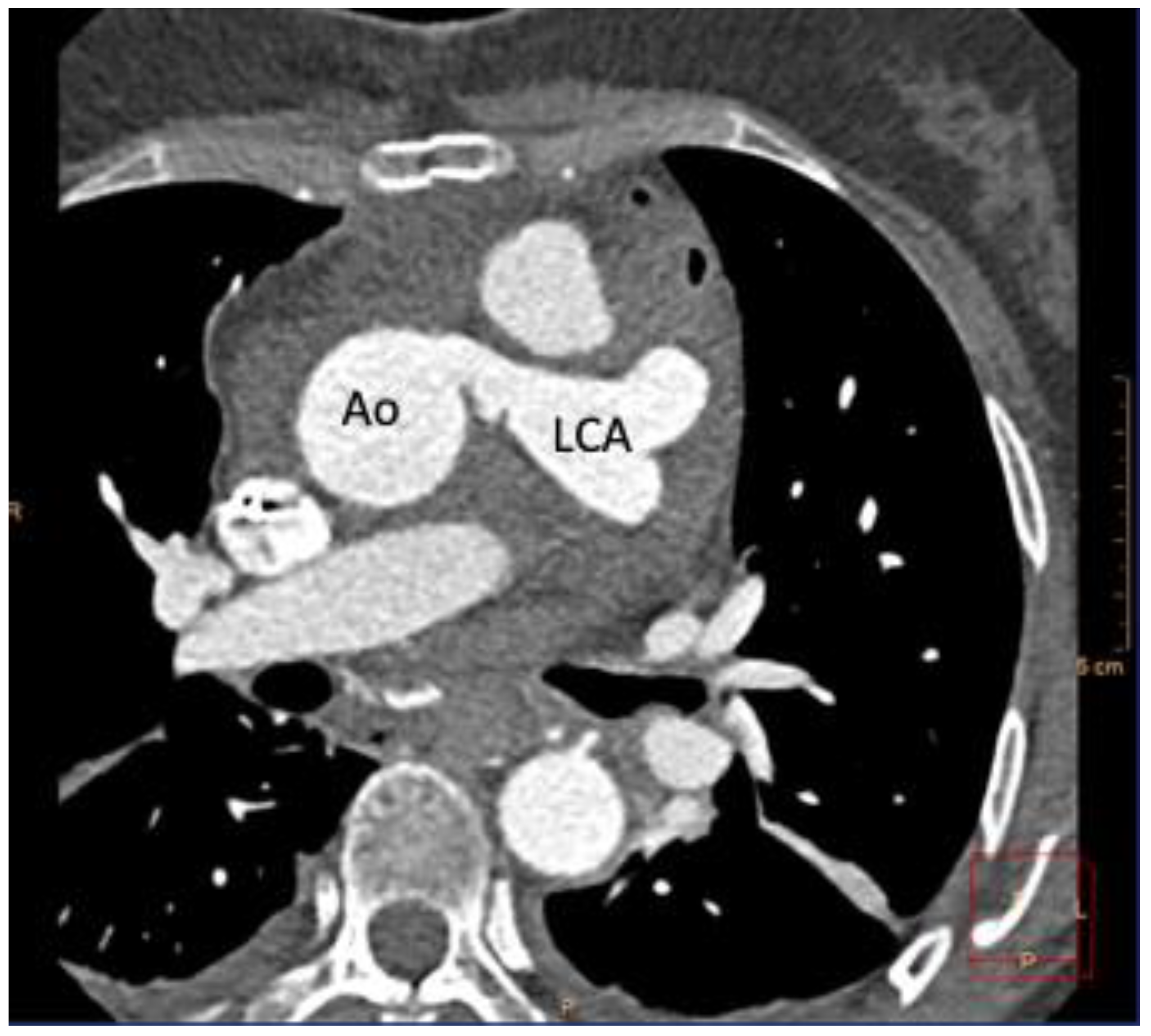 Ijerph 19 01554 g004