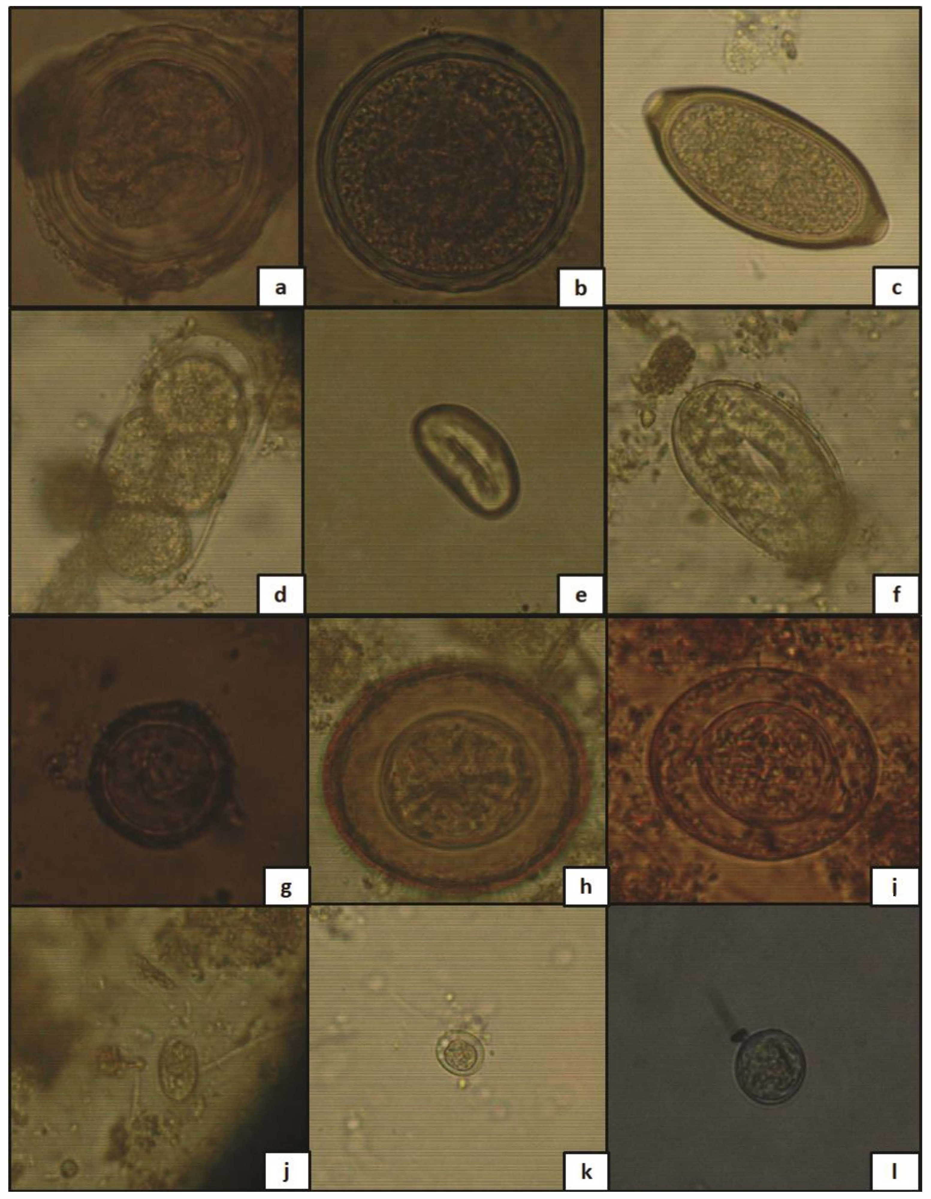 Ijerph 19 01657 g003