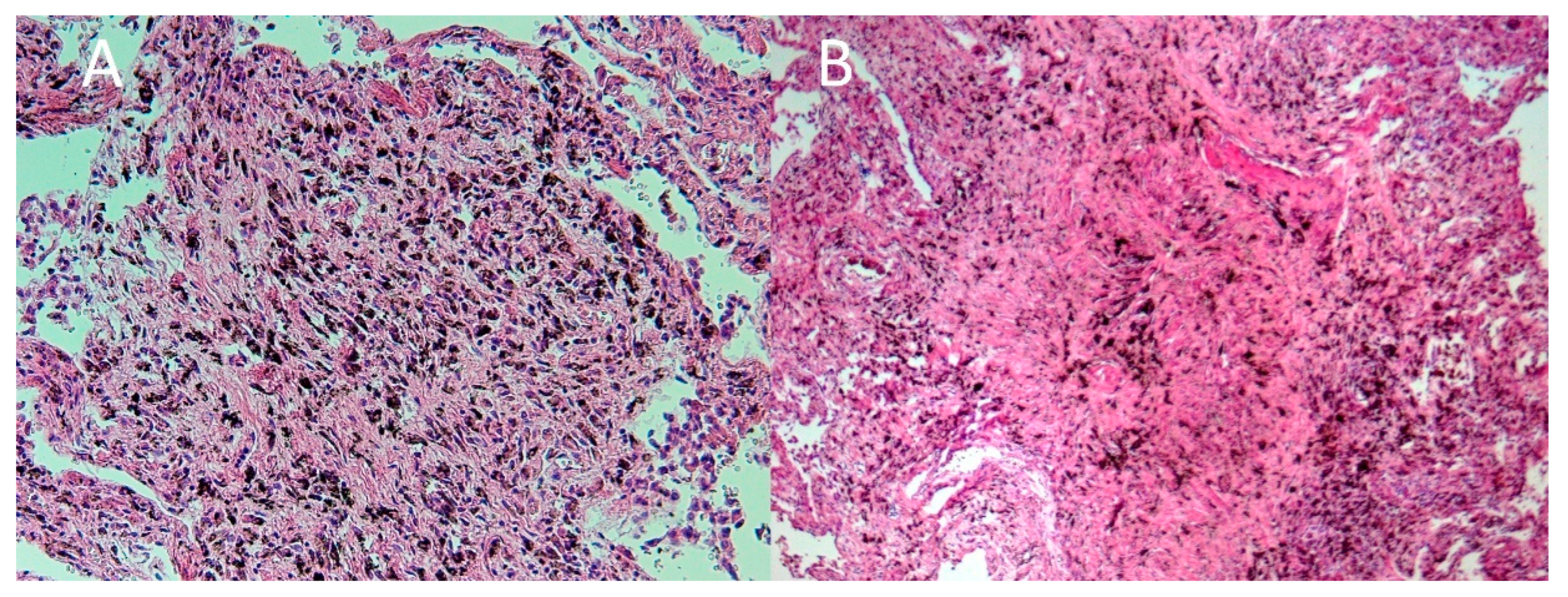 Ijerph 19 02297 g005