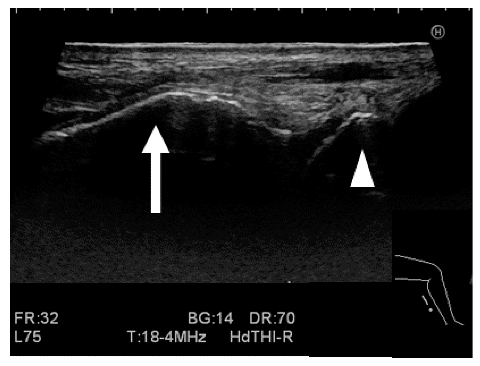 Ijerph 19 02367 g002