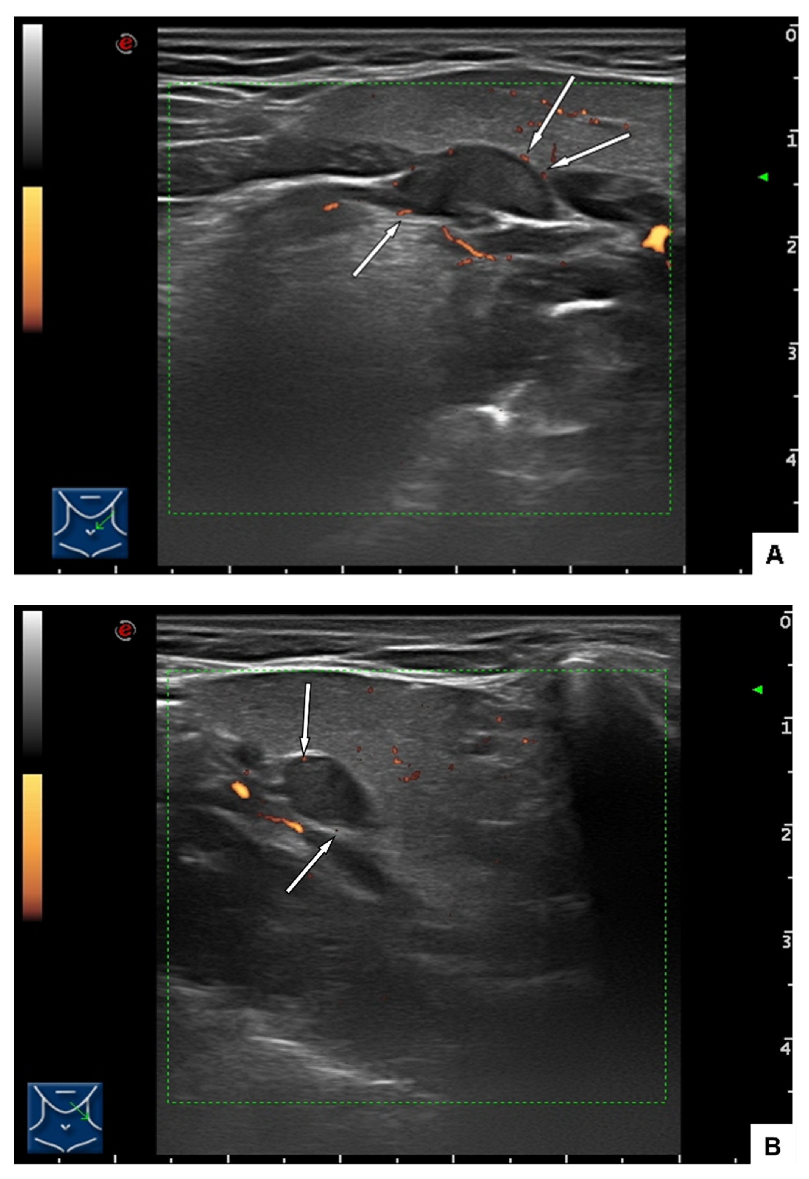 Ijerph 19 02690 g003