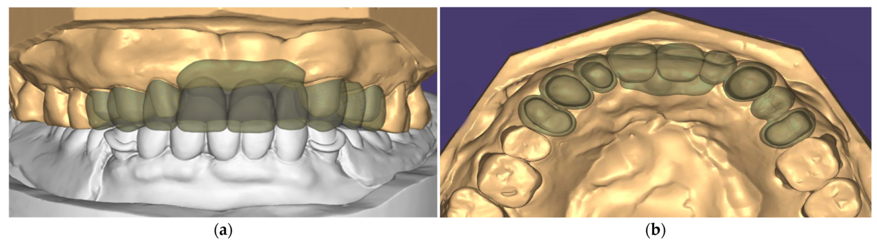 Ijerph 19 03021 g005