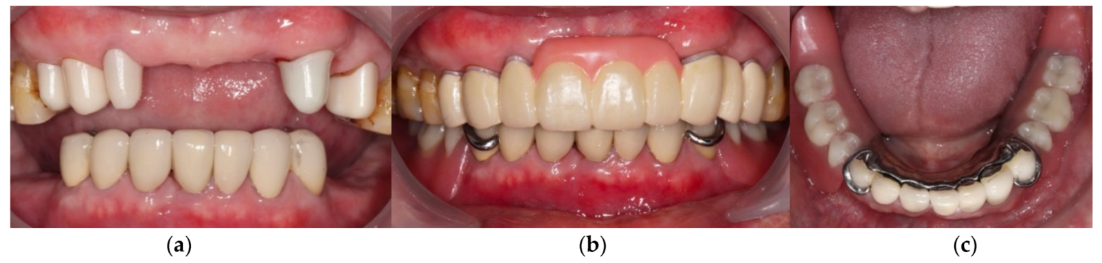 Ijerph 19 03021 g008