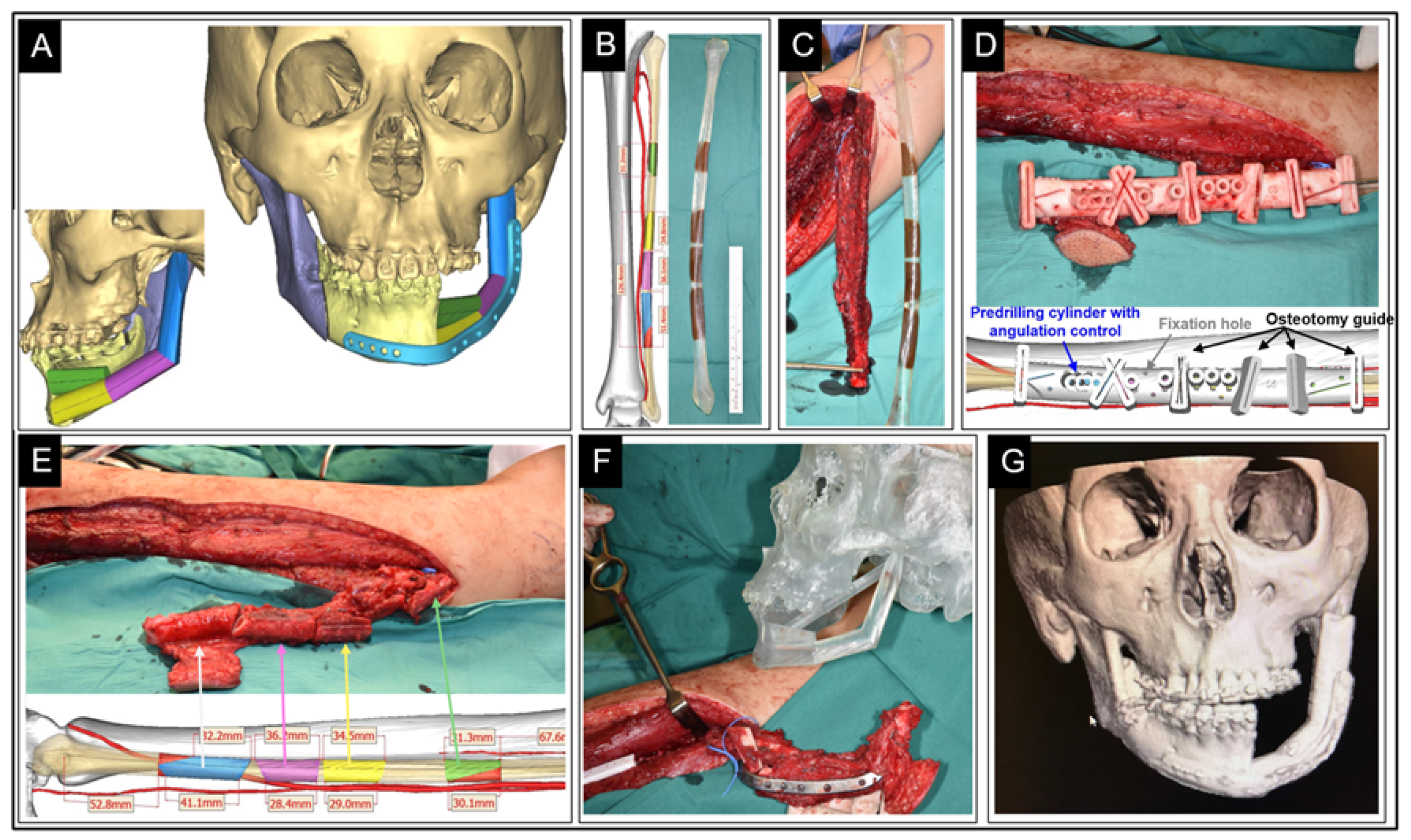 Ijerph 19 03331 g008