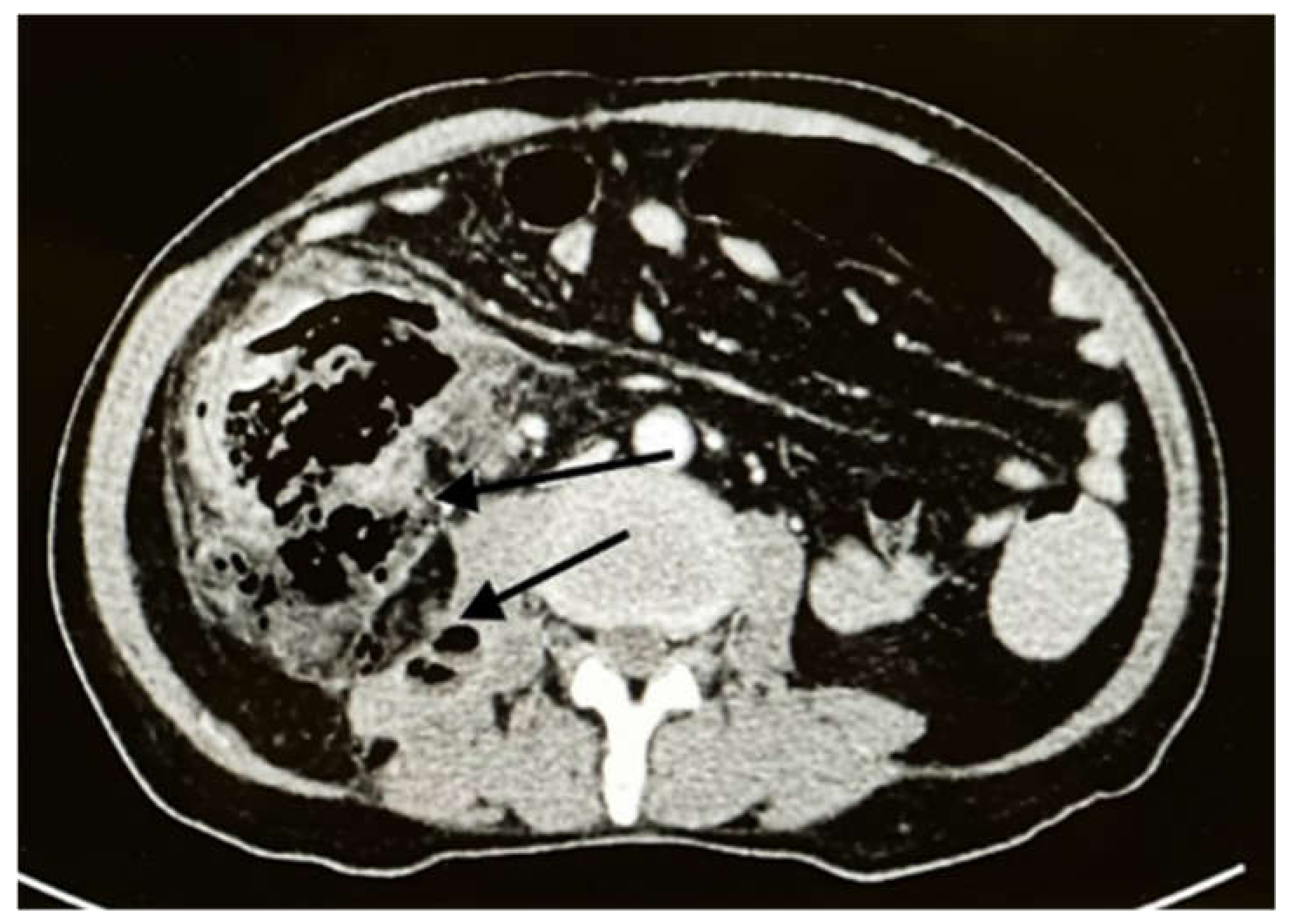 Ijerph 19 03412 g002