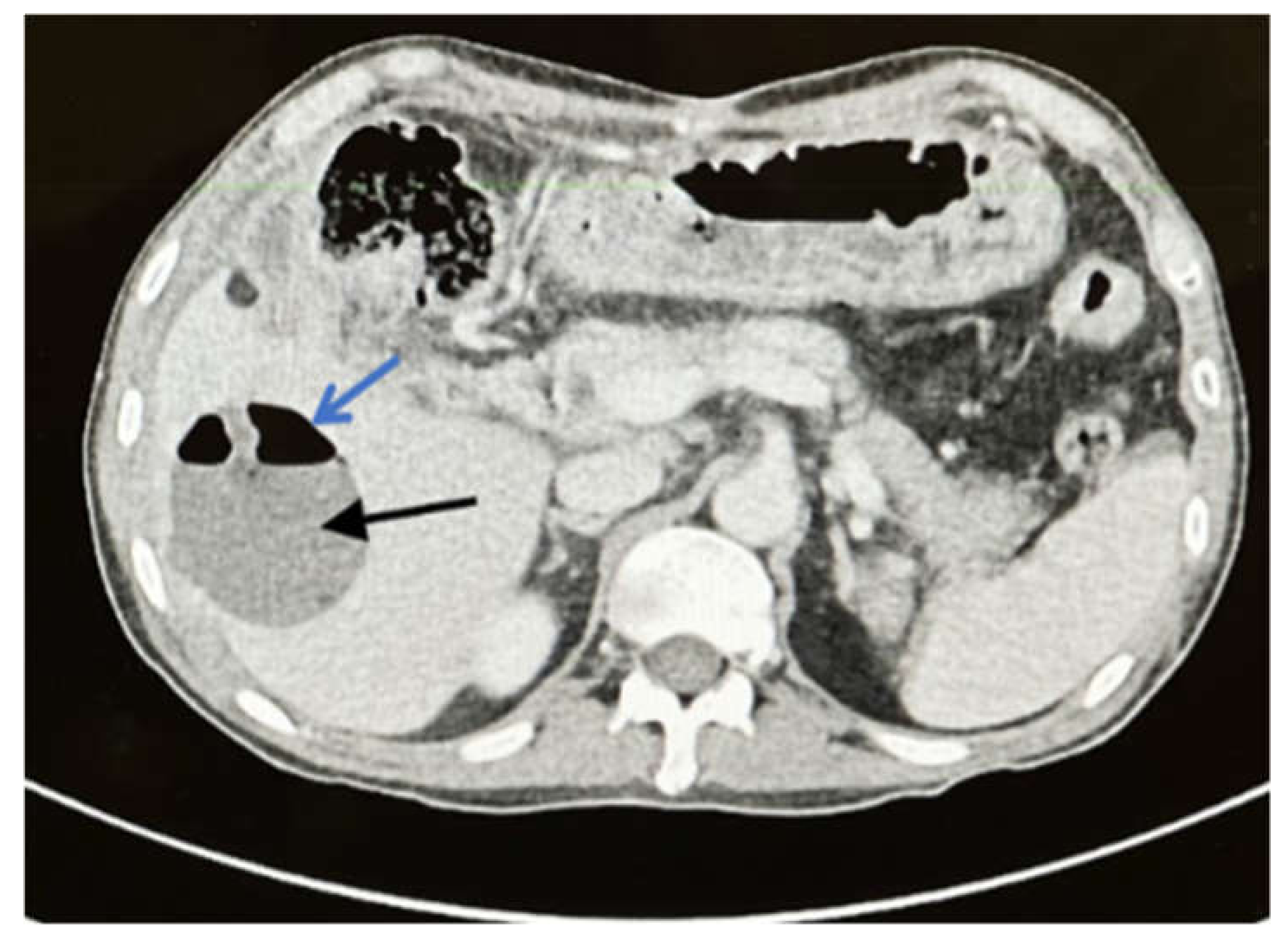 Ijerph 19 03412 g004