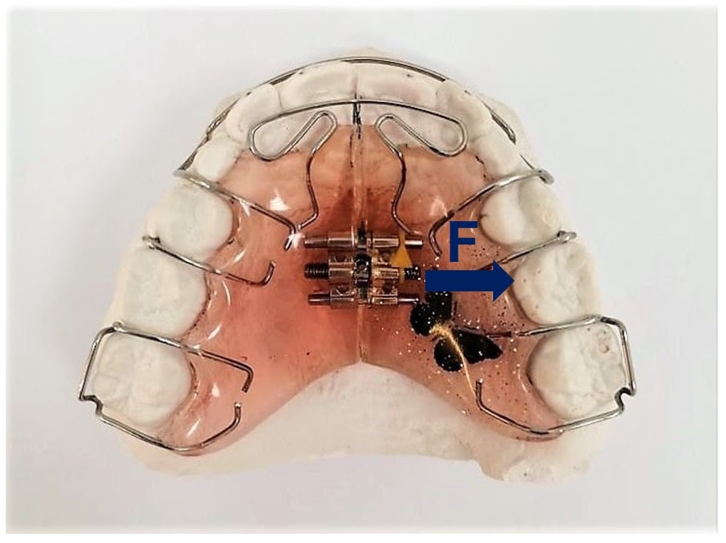Ijerph 19 03442 g003 Ijerph 19 03442 g003