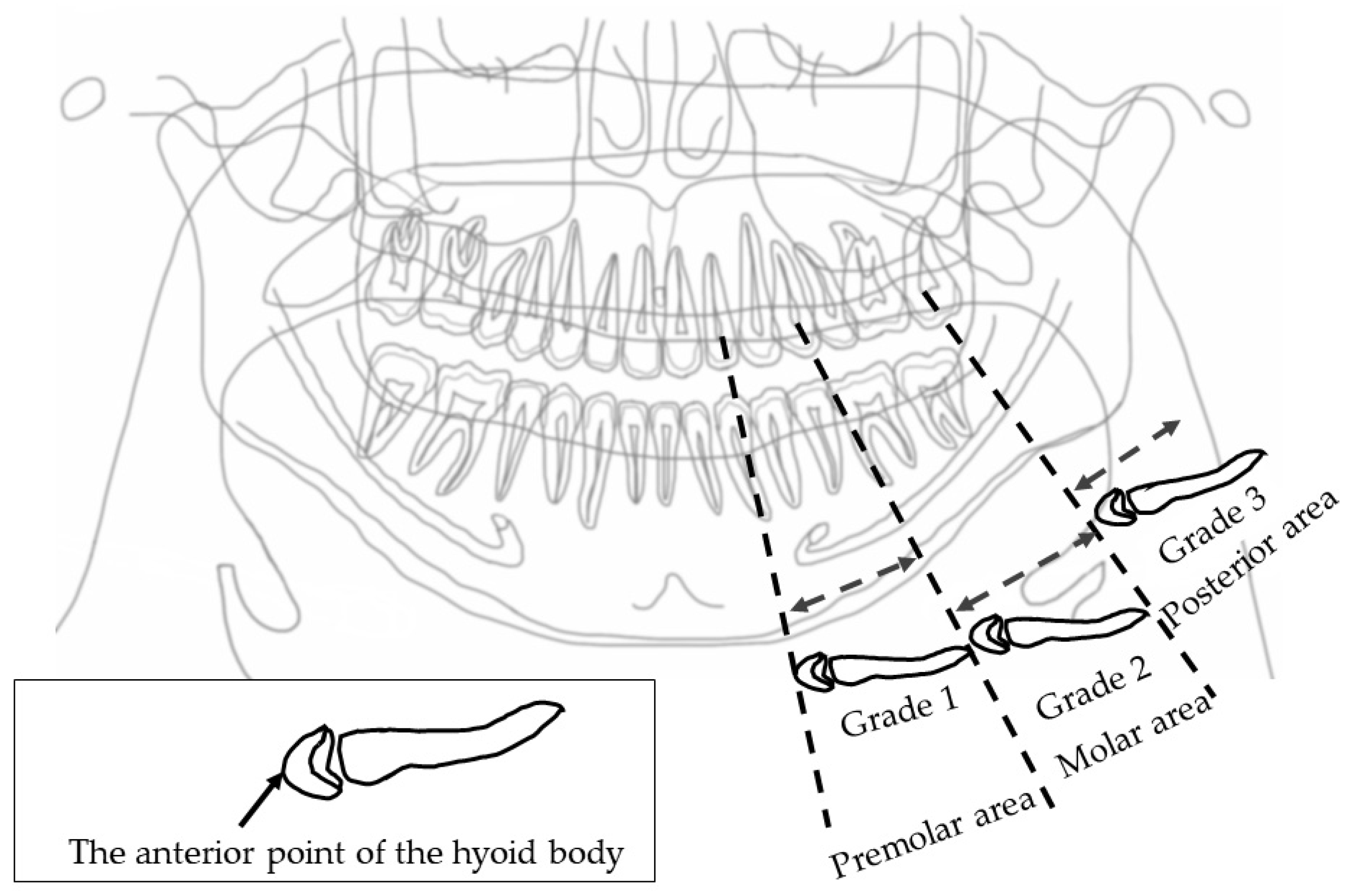 Ijerph 19 04529 g003
