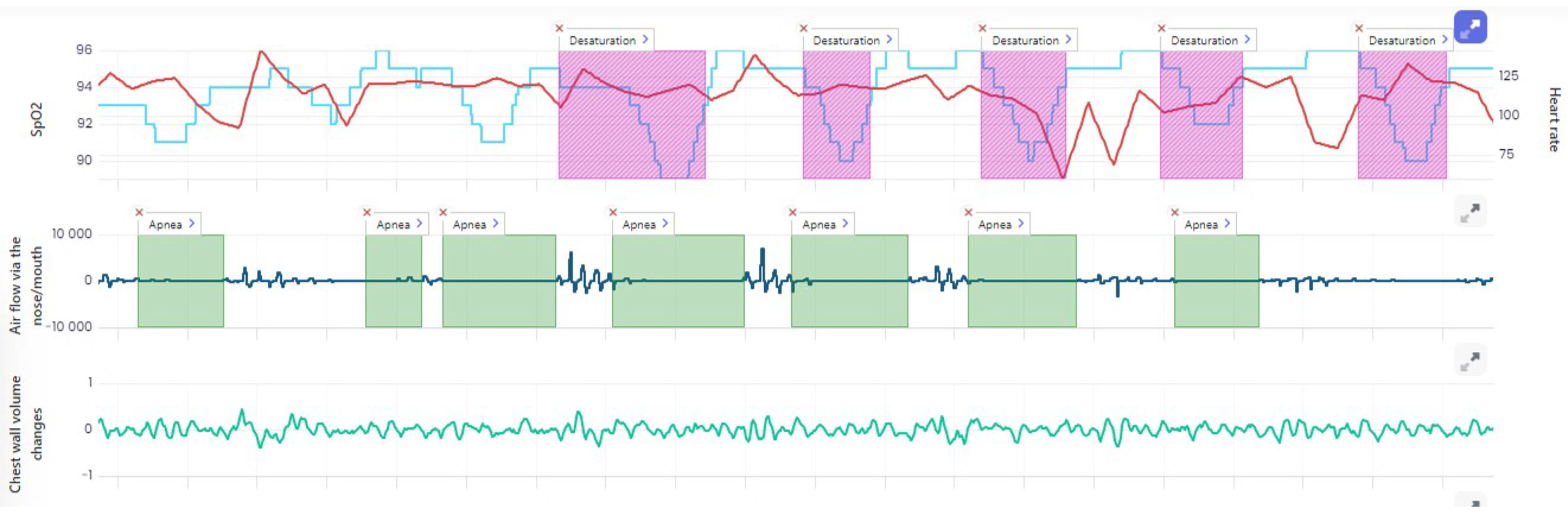 Ijerph 19 05268 g004