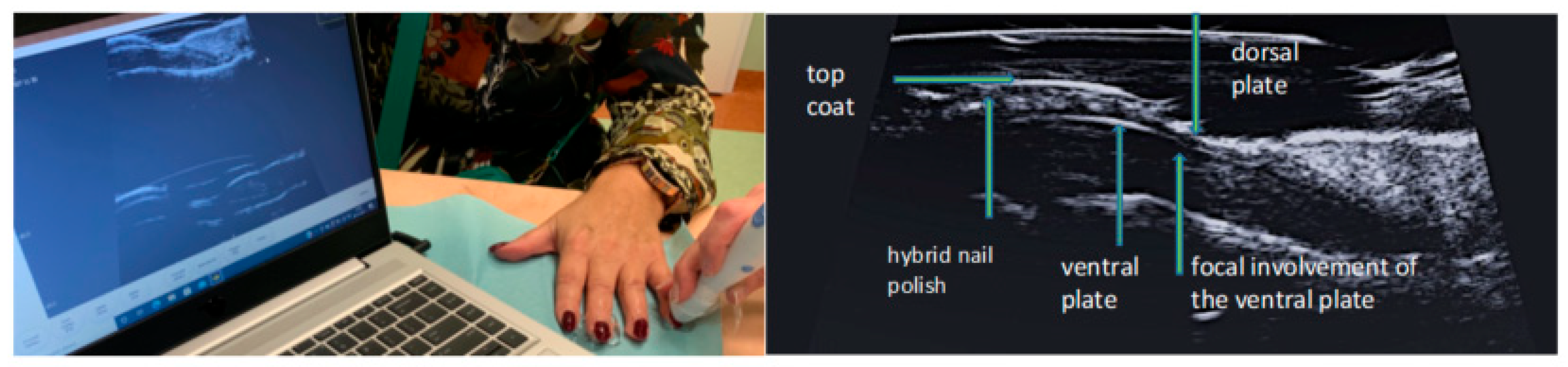 Ijerph 19 05611 g007