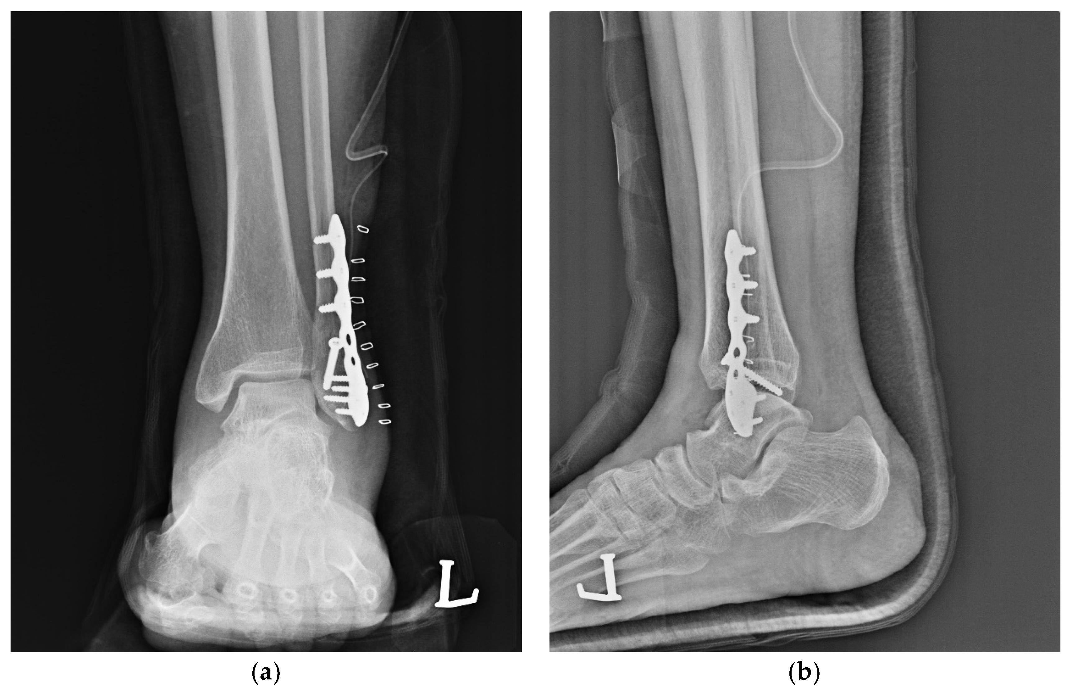 Ijerph 19 06052 g003