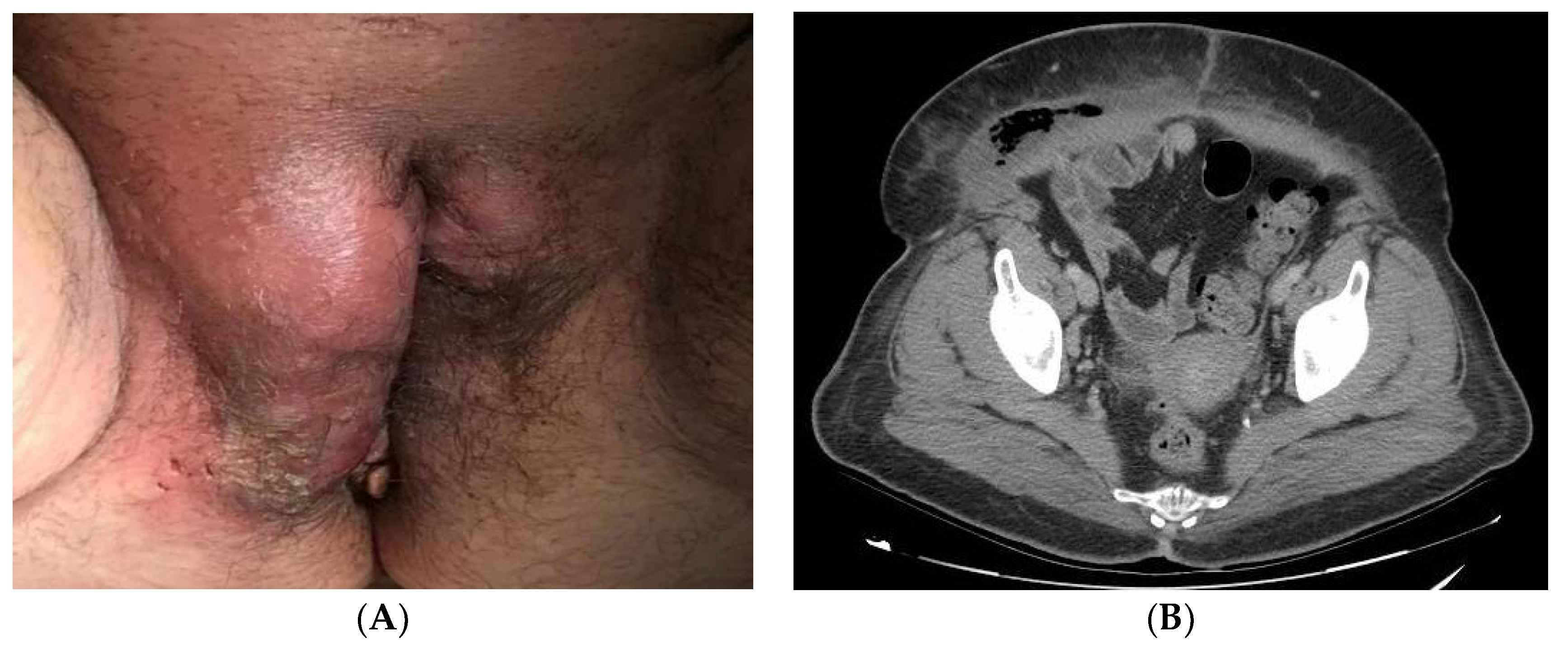 Ijerph 19 06261 g001