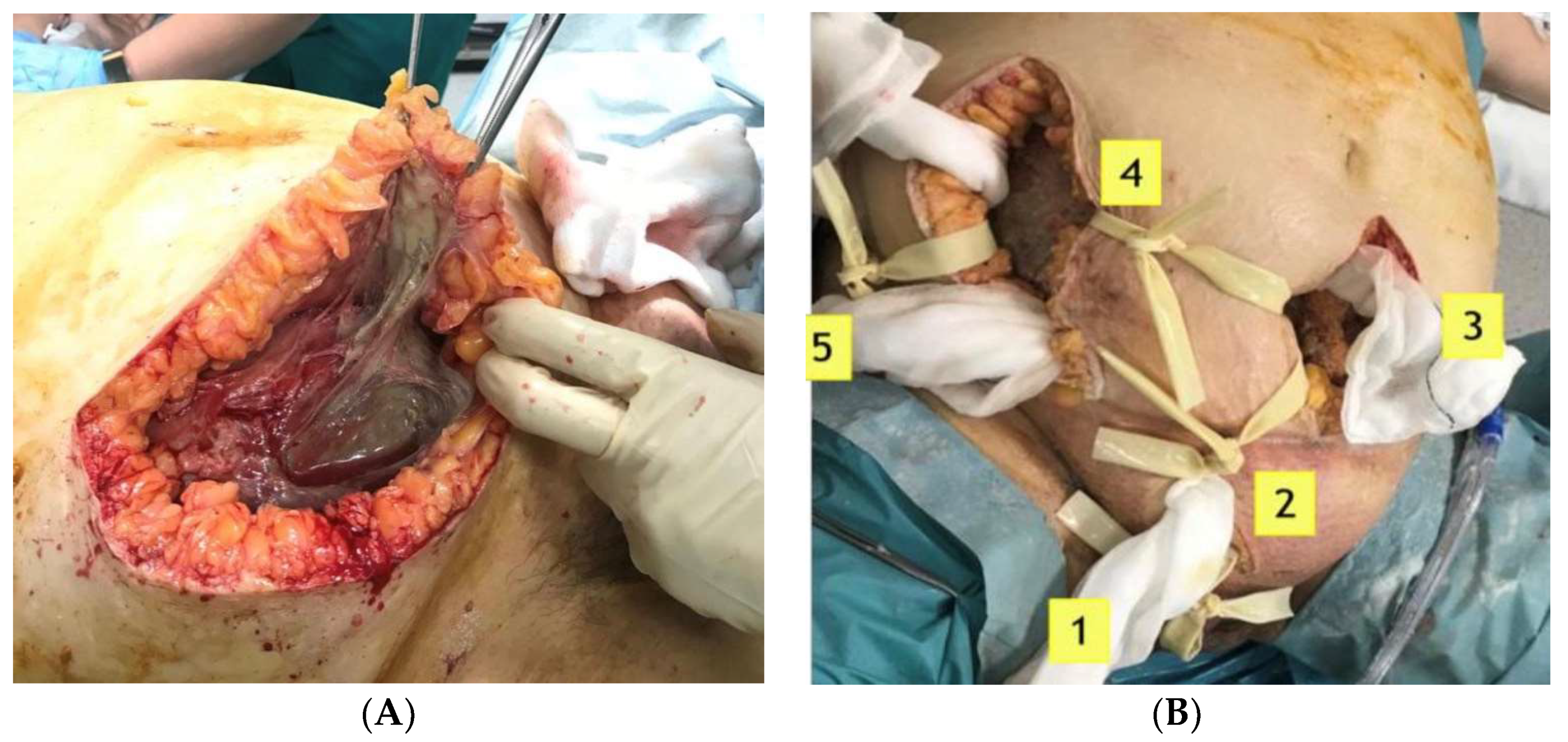 Ijerph 19 06261 g002