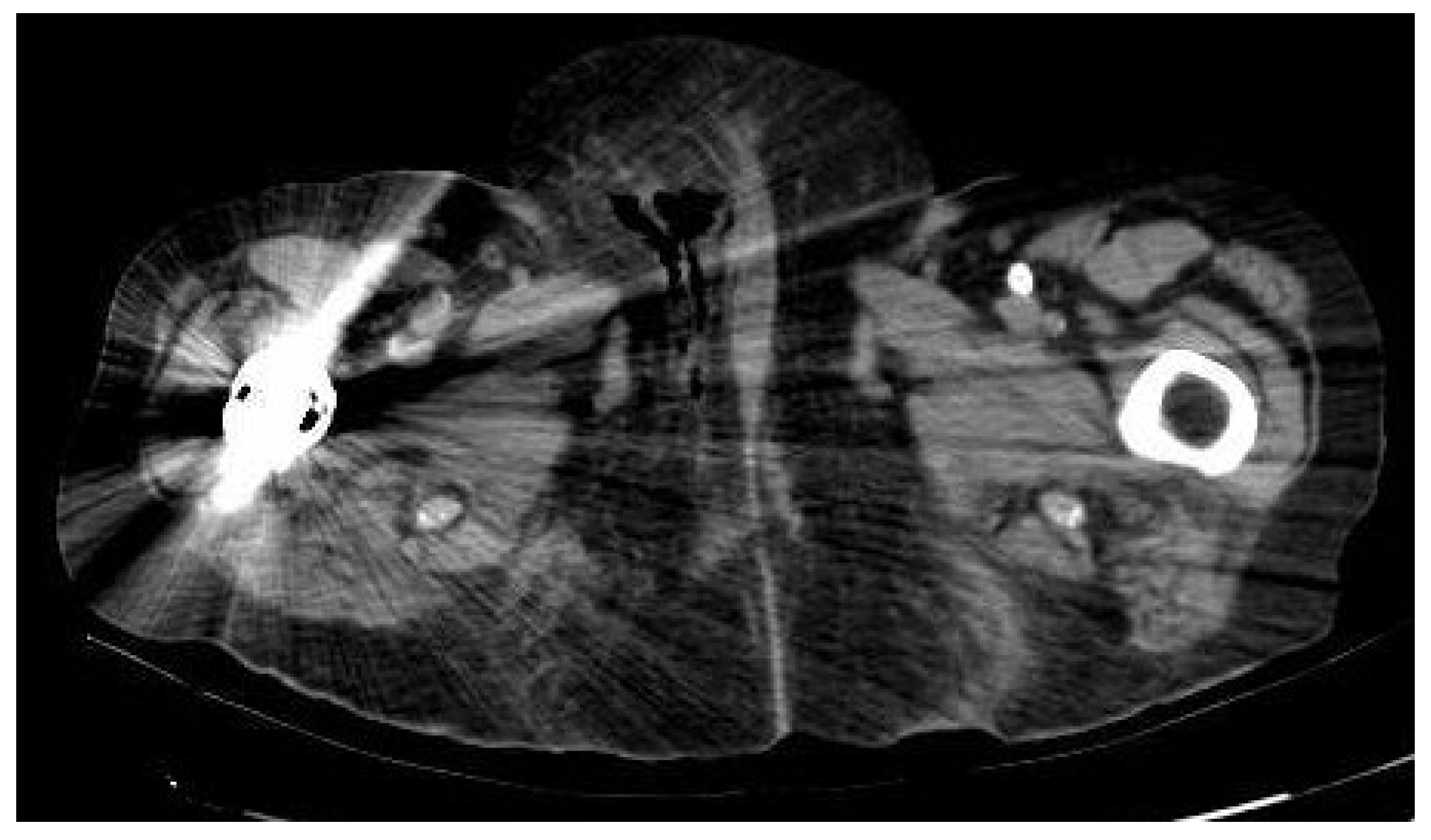 Ijerph 19 06261 g003