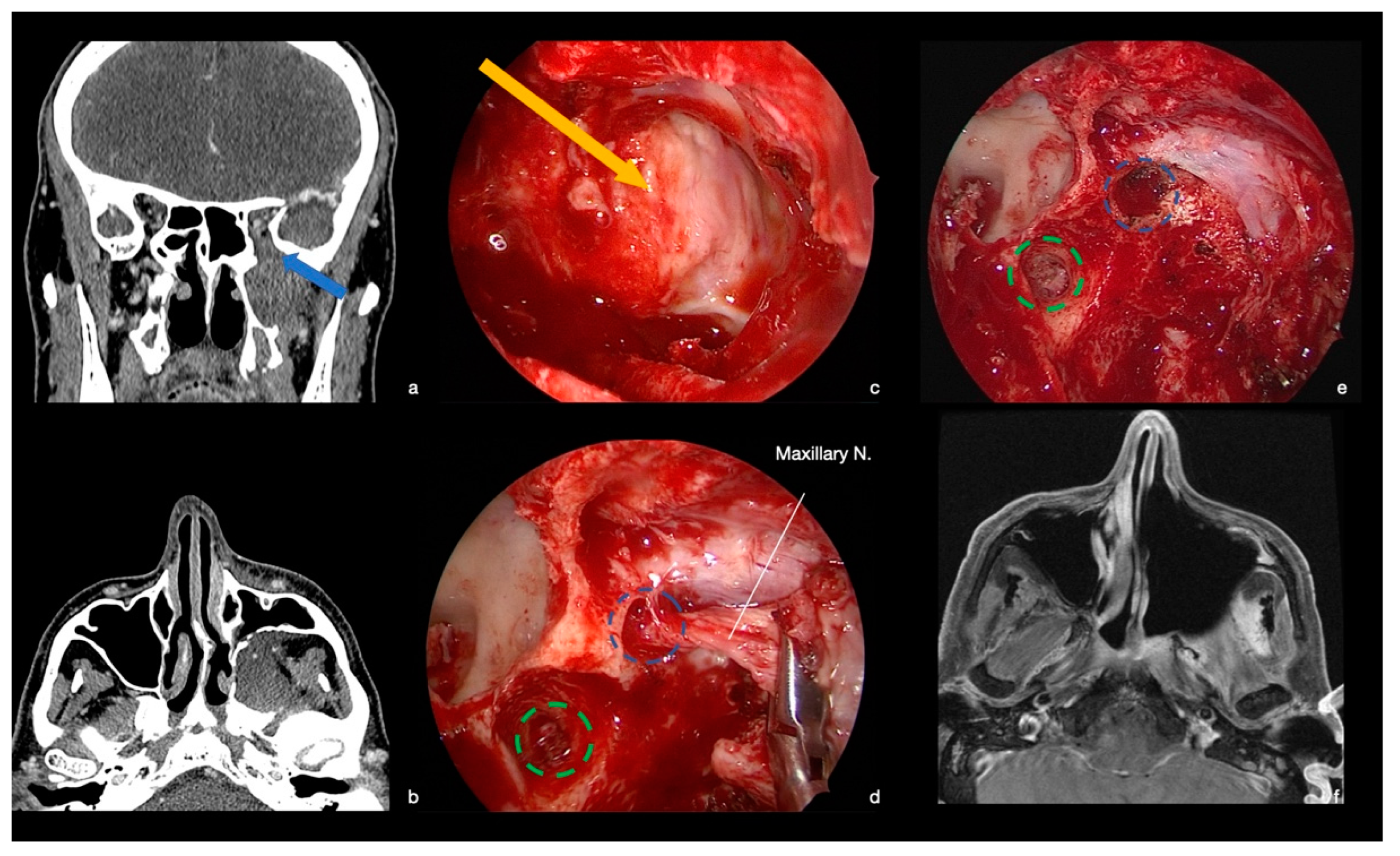 Ijerph 19 06413 g005