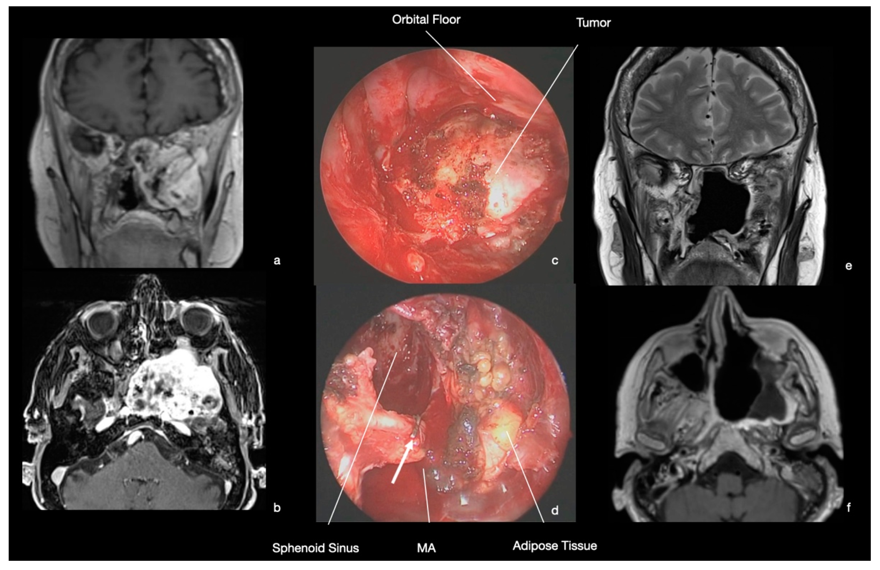 Ijerph 19 06413 g006