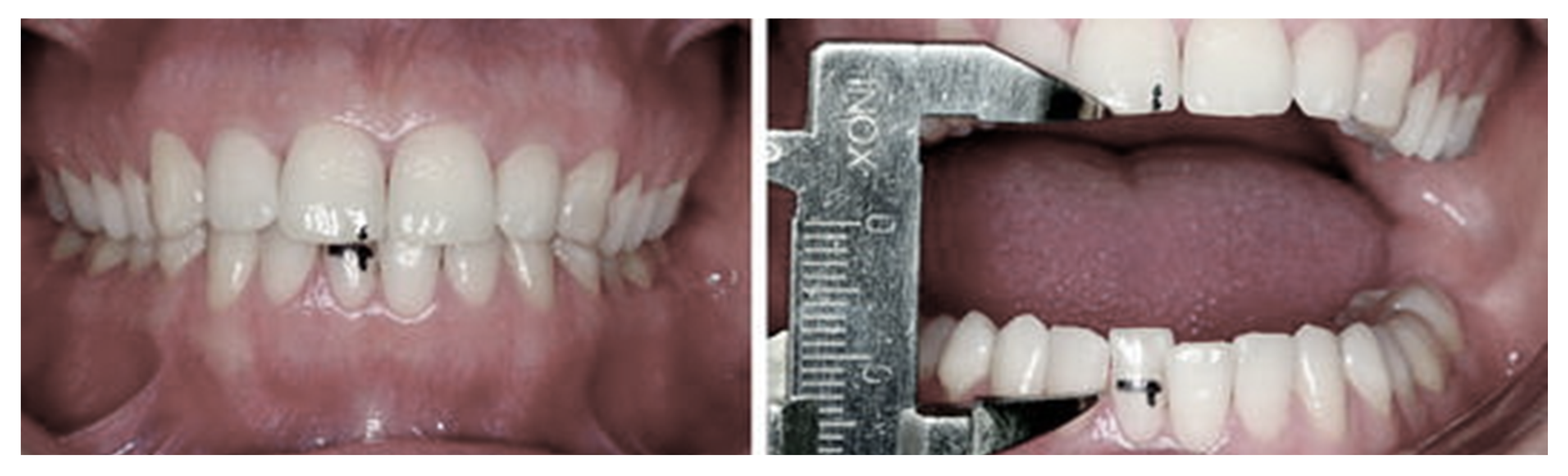 Ijerph 19 06888 g004