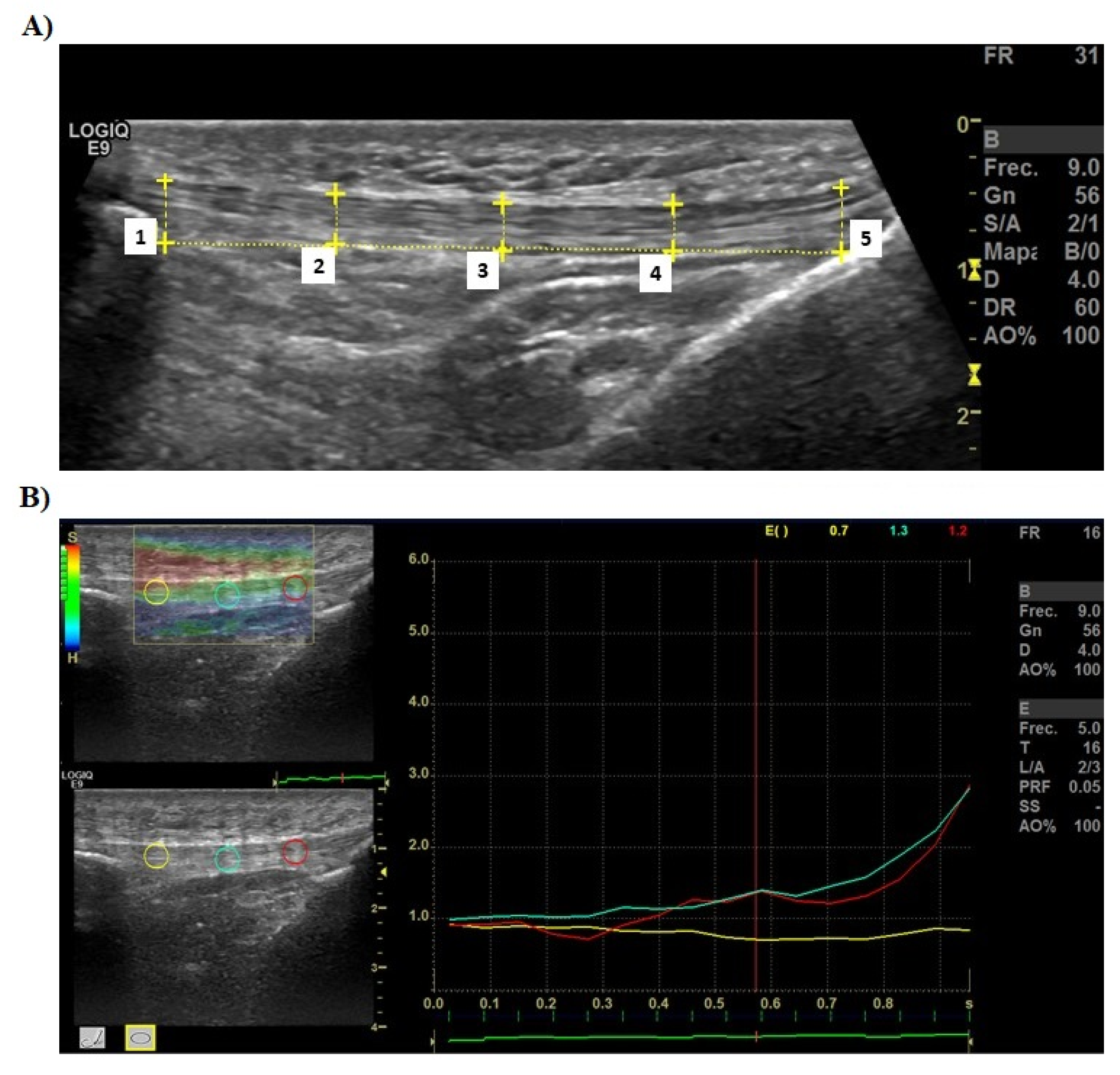 Ijerph 19 09296 g003