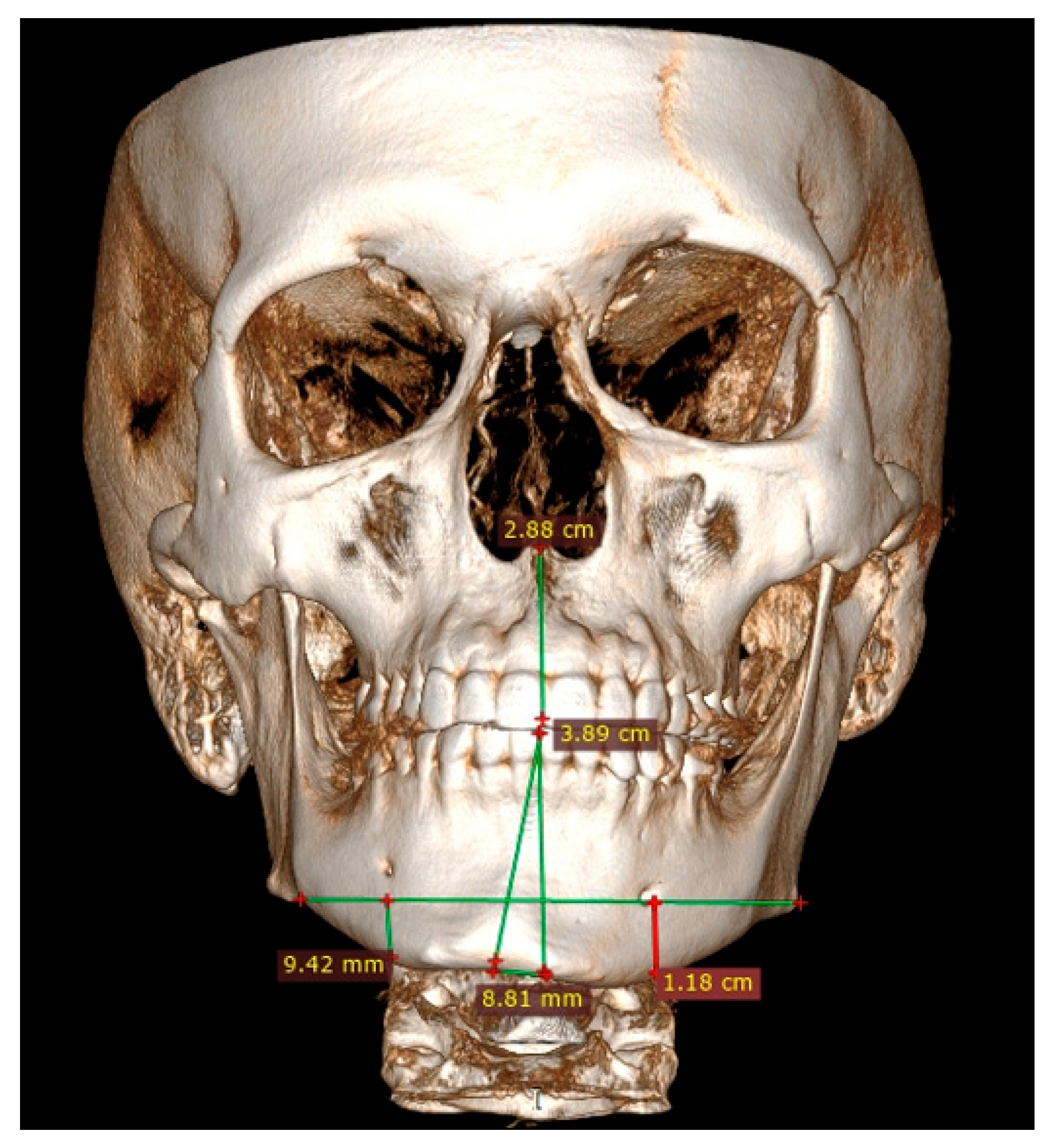 Ijerph 19 10005 g003