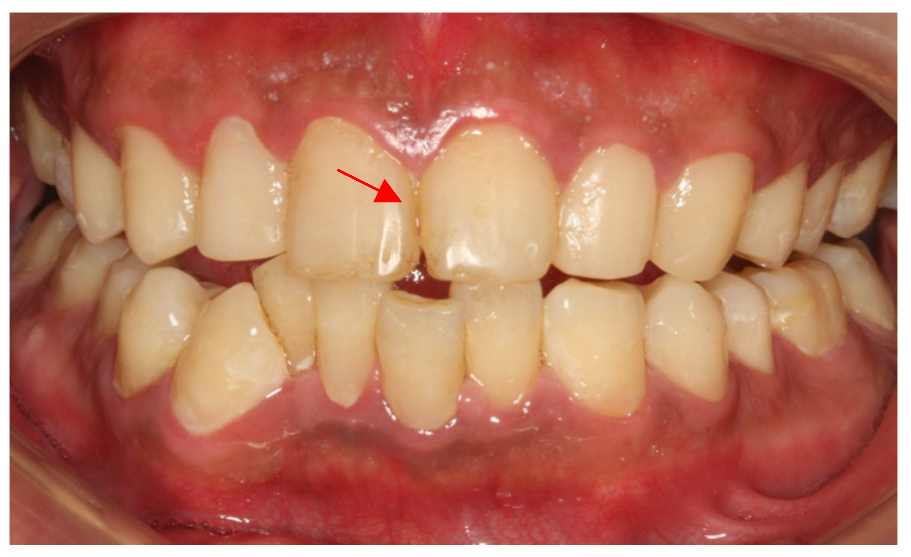 Ijerph 19 14069 g007 Ijerph 19 14069 g007