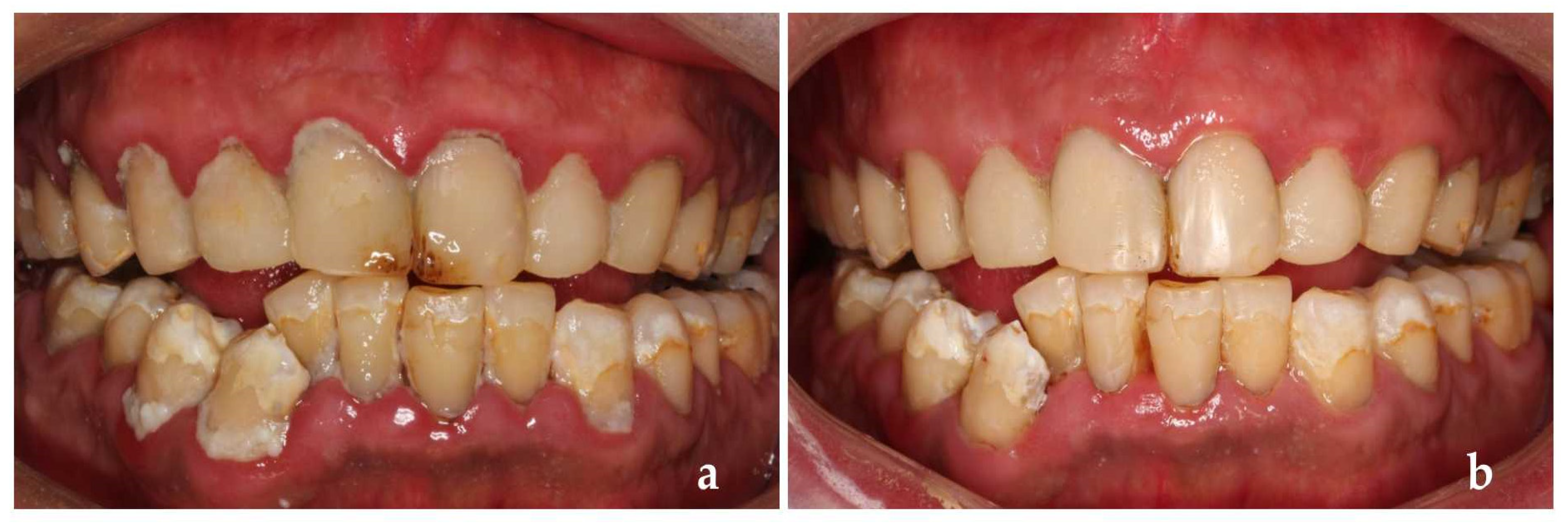 Ijerph 19 14069 g008 Ijerph 19 14069 g008
