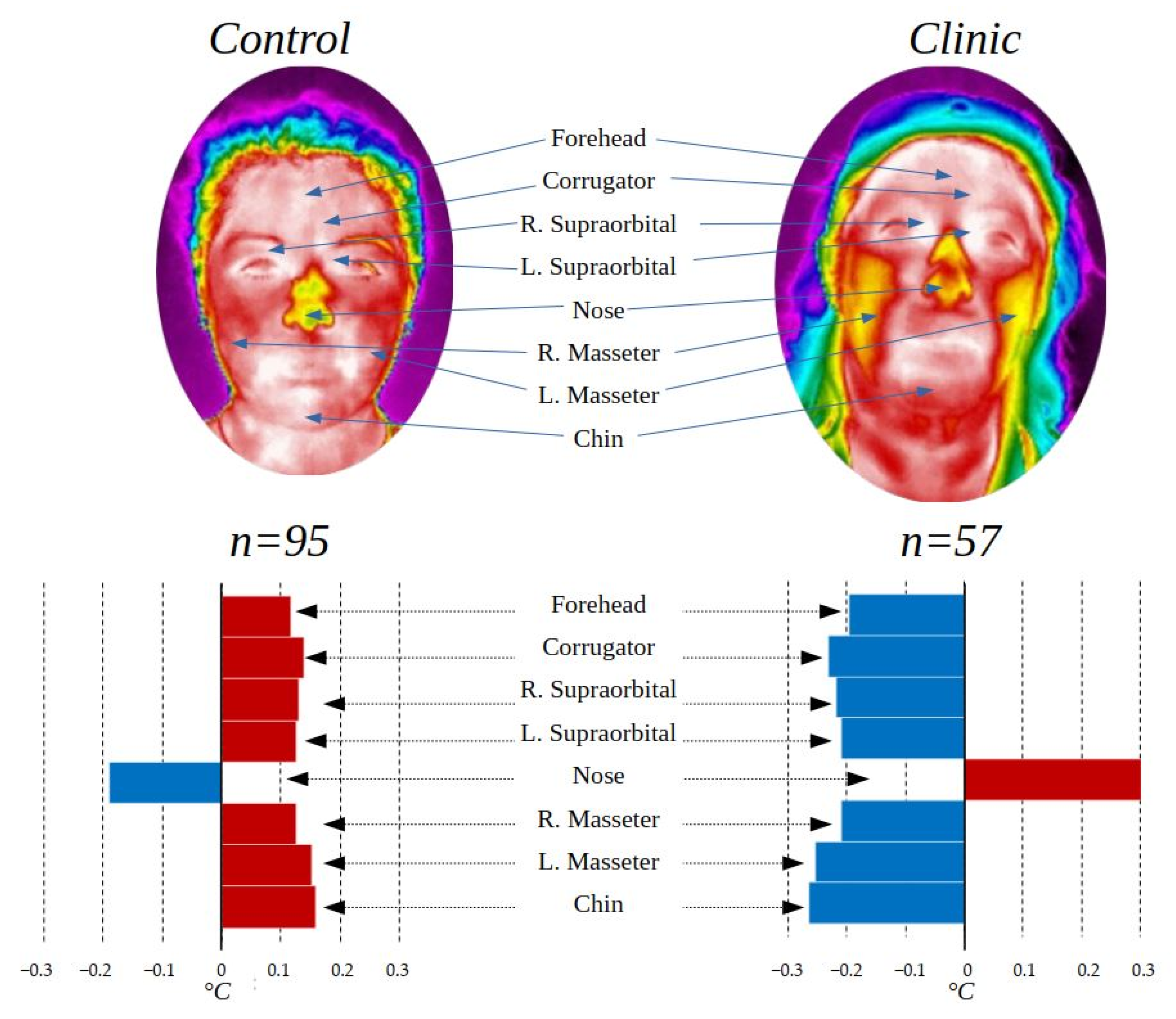 Ijerph 19 14208 g009 Ijerph 19 14208 g009