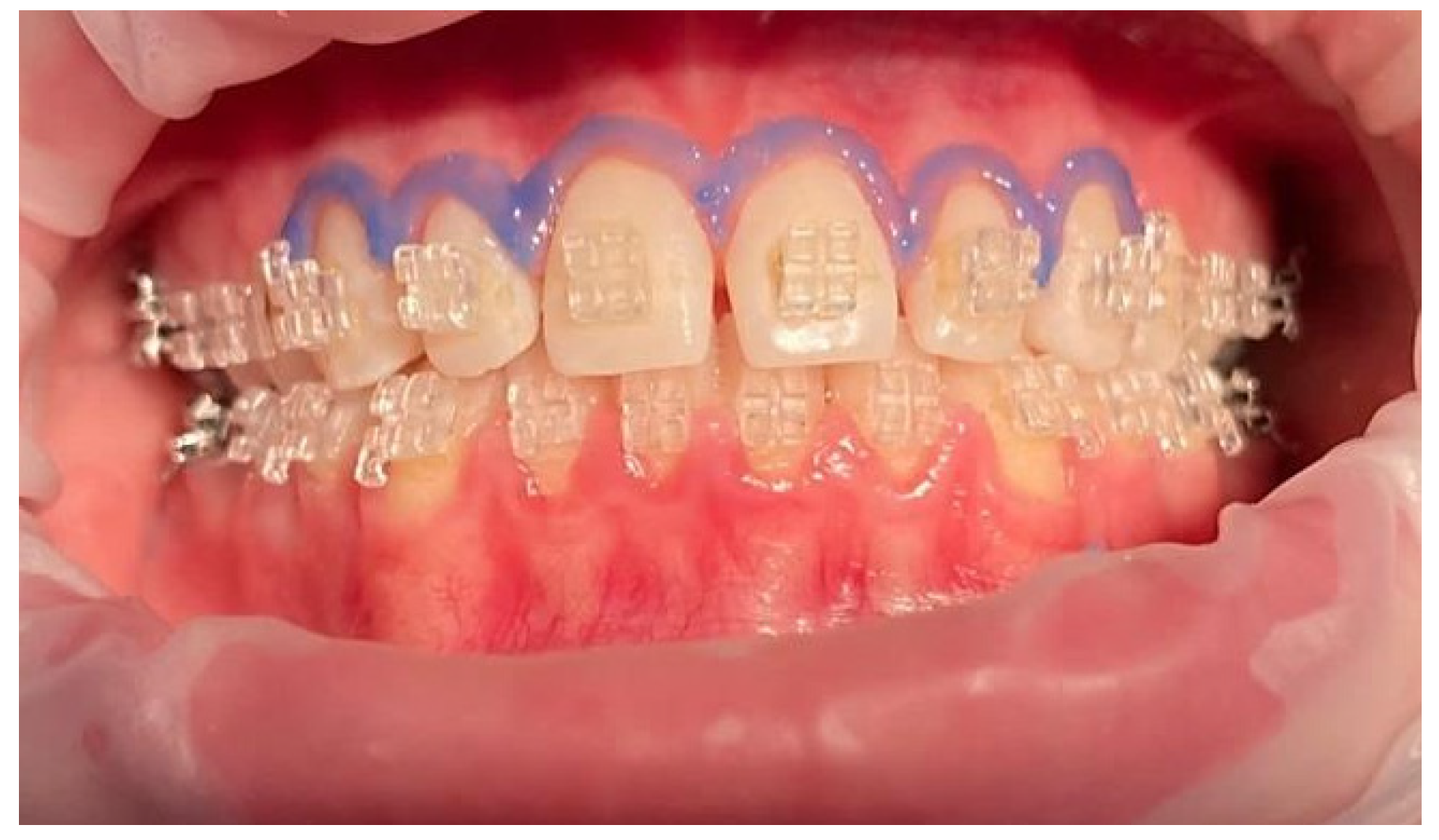 Ijerph 19 14564 g004 Ijerph 19 14564 g004