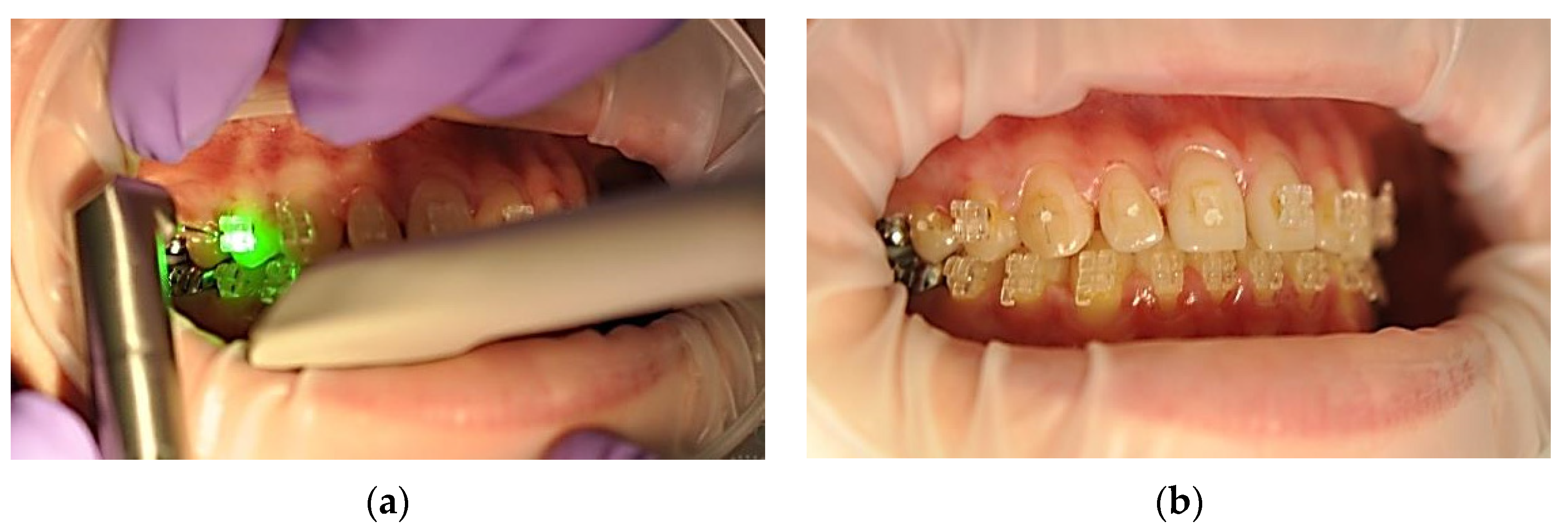 Ijerph 19 14564 g006 Ijerph 19 14564 g006