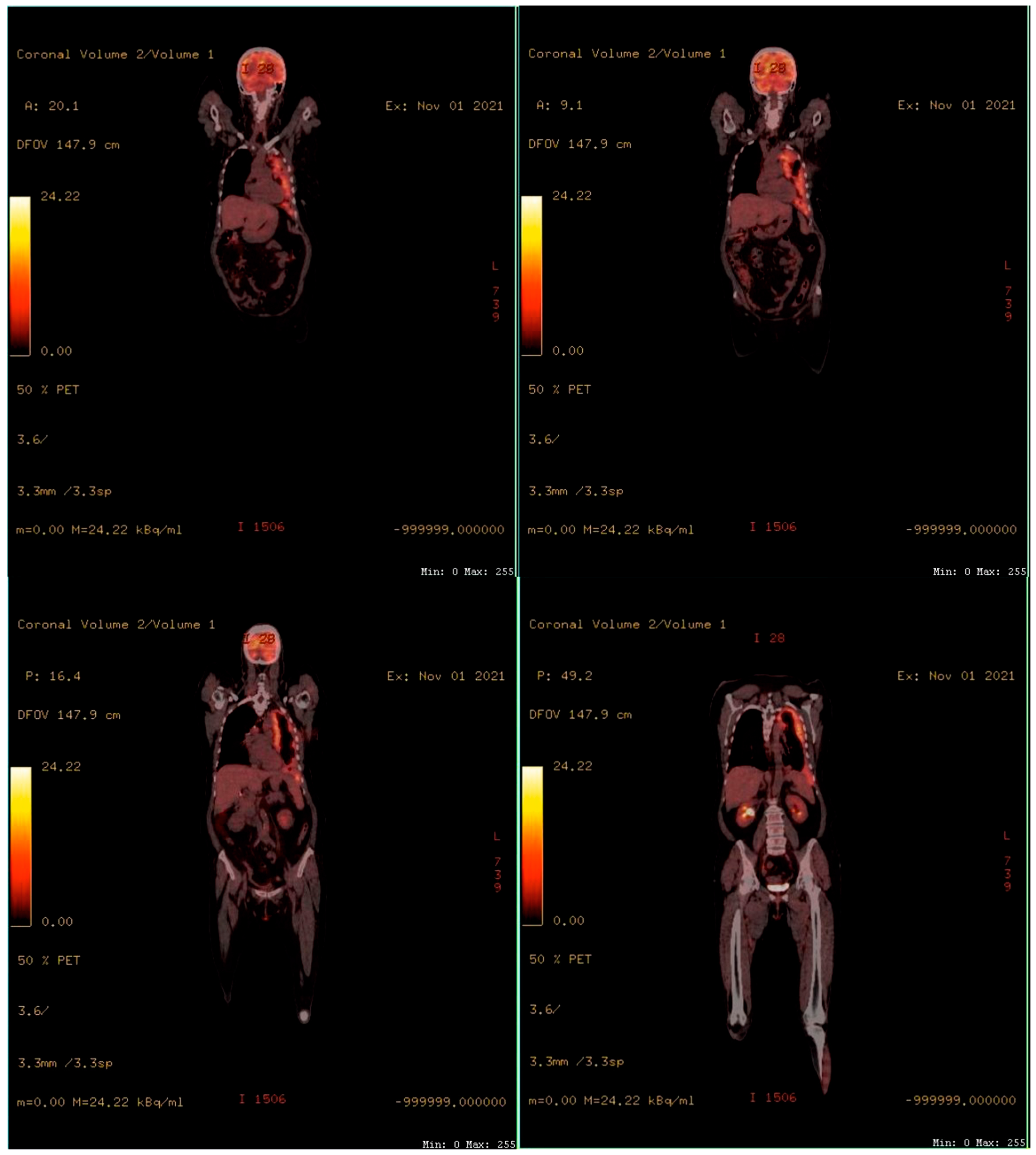 Ijerph 19 14763 g002 Ijerph 19 14763 g002