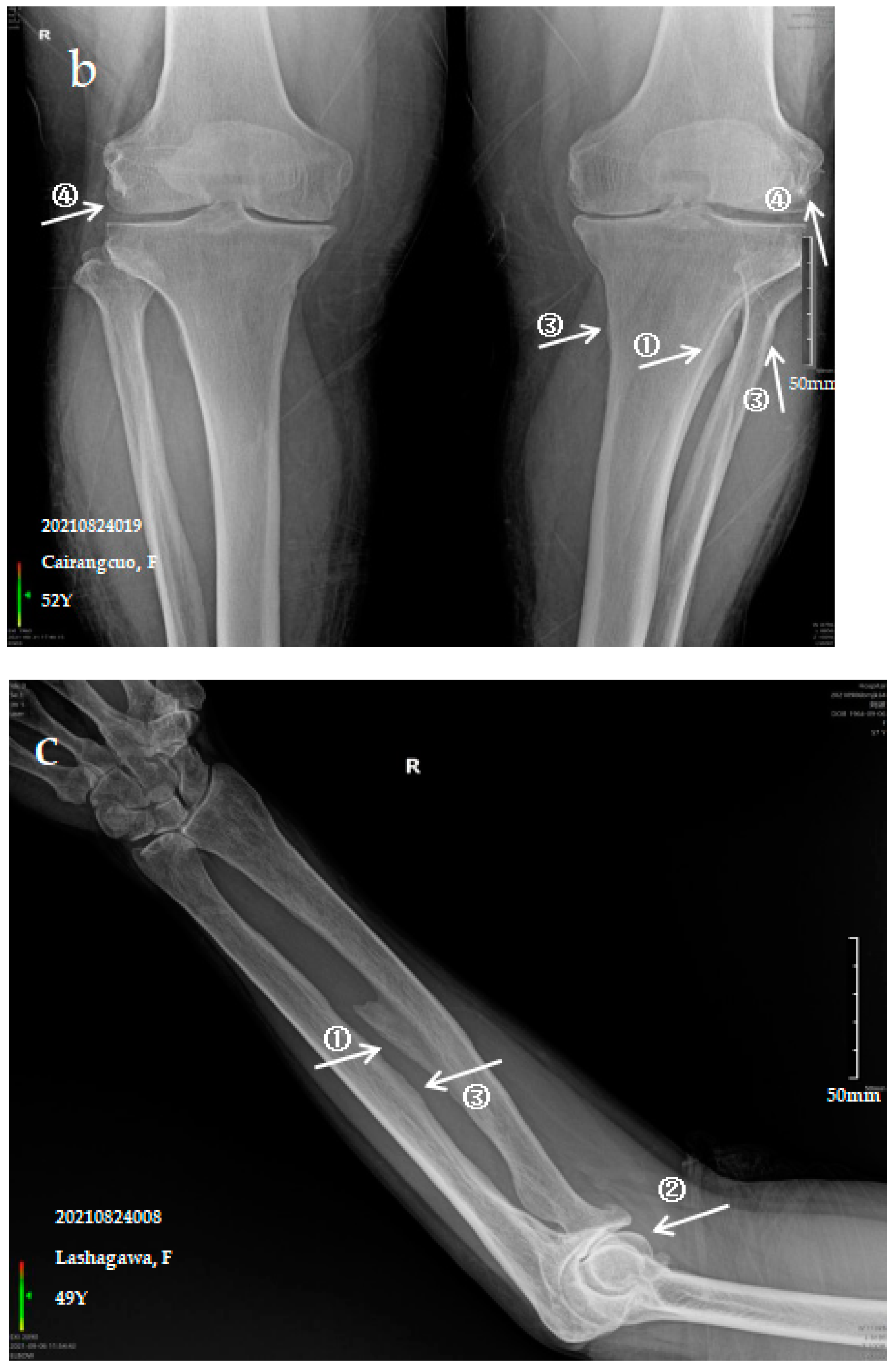 Ijerph 19 16555 g001b Ijerph 19 16555 g001b