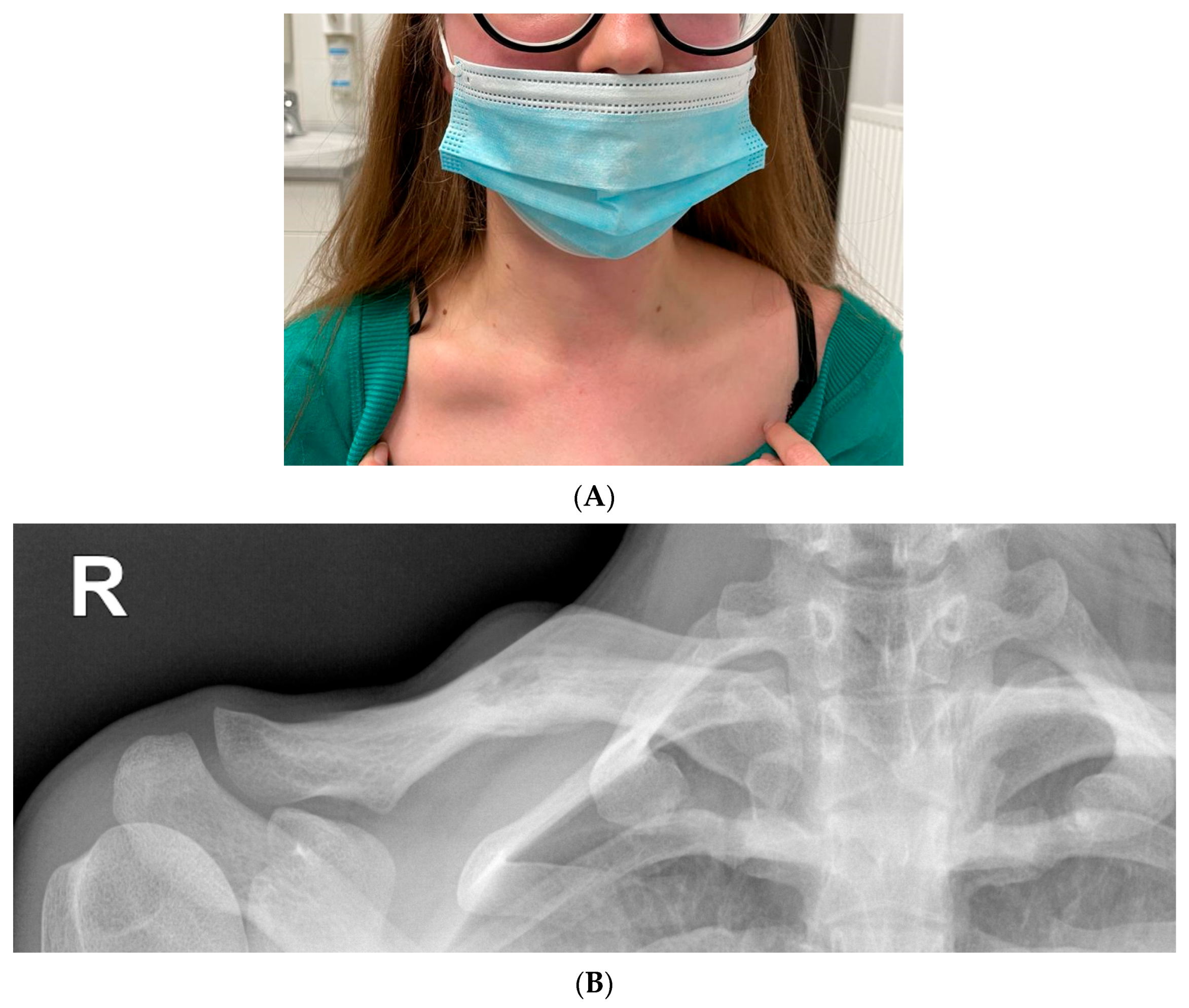 Ijerph 19 16992 g007 Ijerph 19 16992 g007