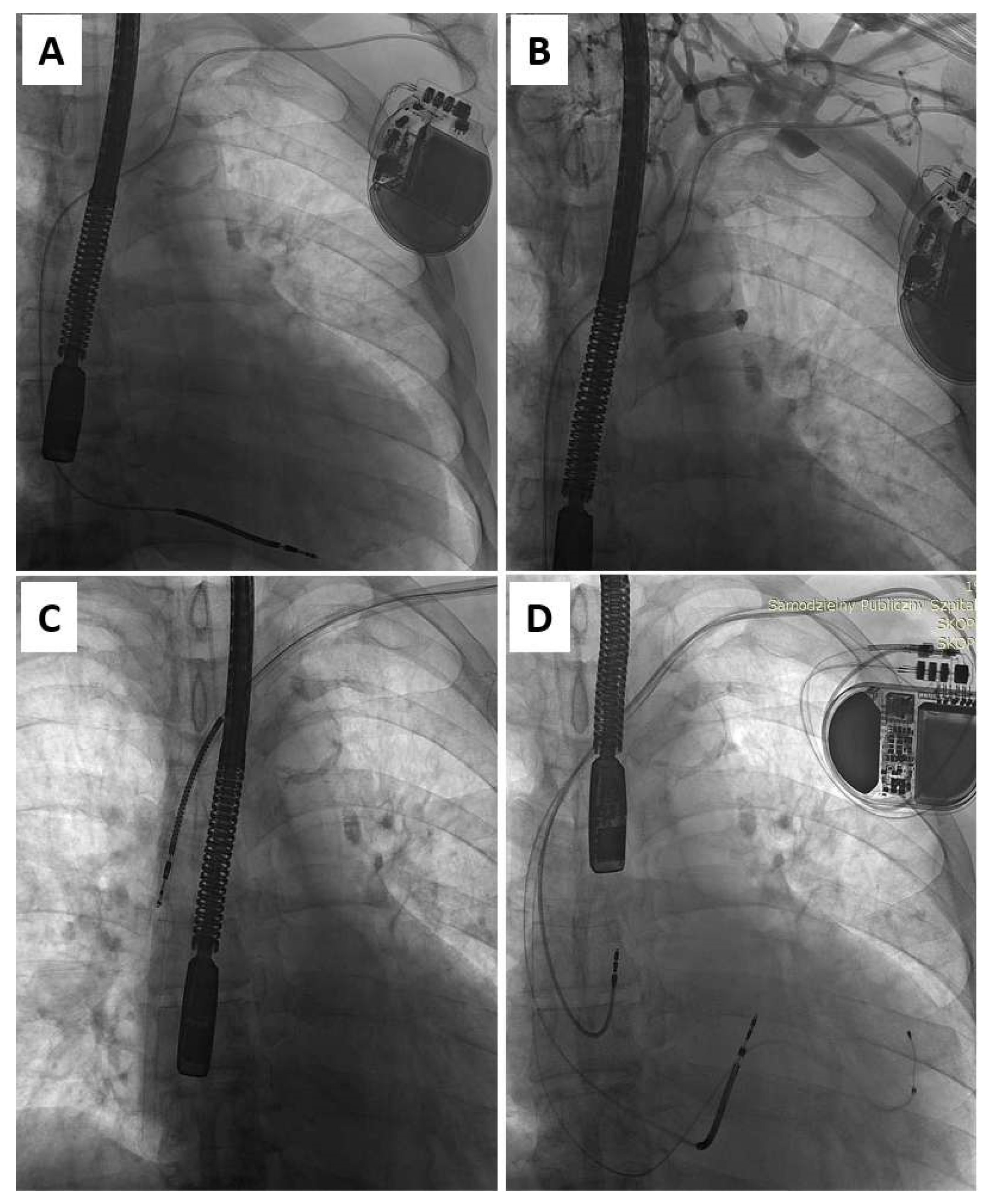 Ijerph 20 00291 g001