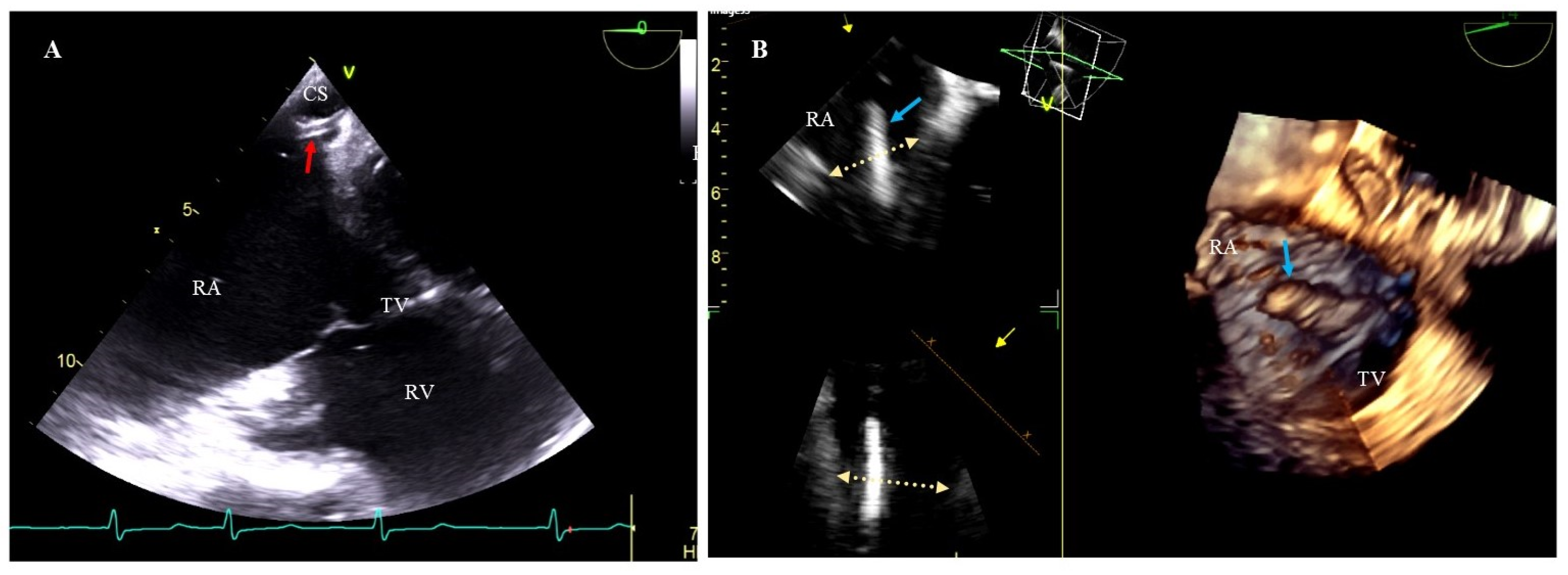 Ijerph 20 00291 g002