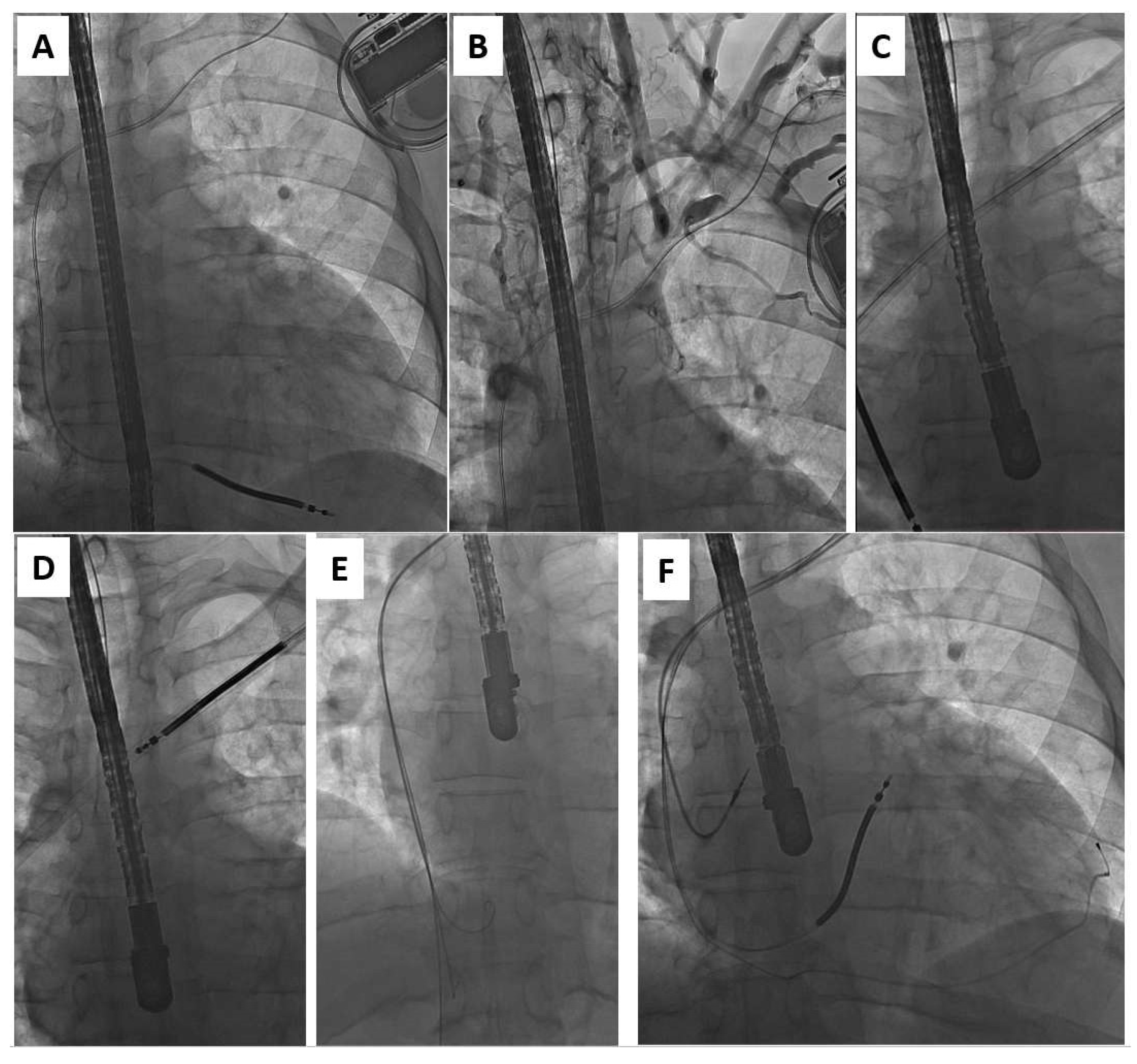 Ijerph 20 00291 g003