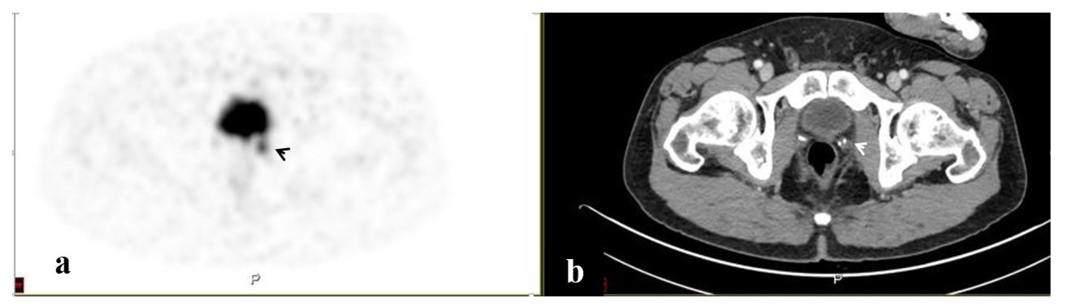 Ijerph 20 00537 g004
