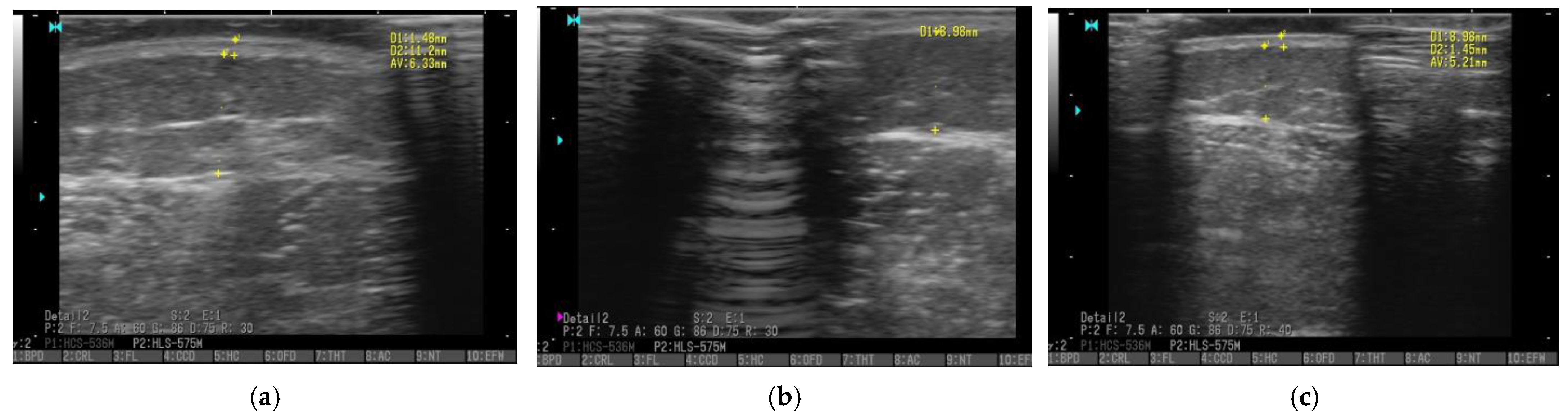 Ijerph 20 00914 g004