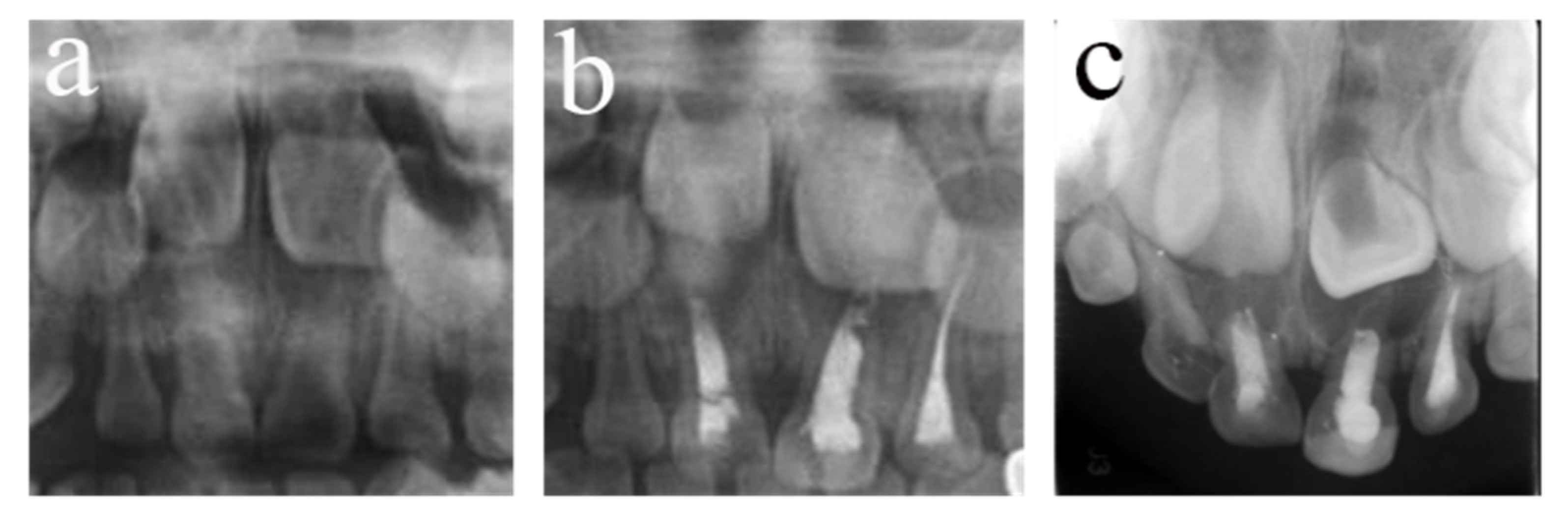 Ijerph 20 01191 g004