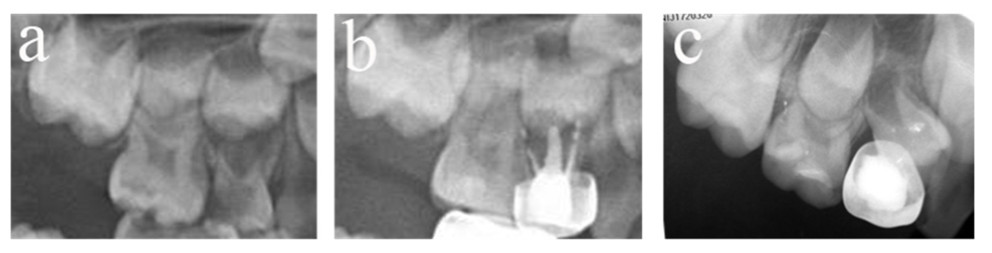 Ijerph 20 01191 g005