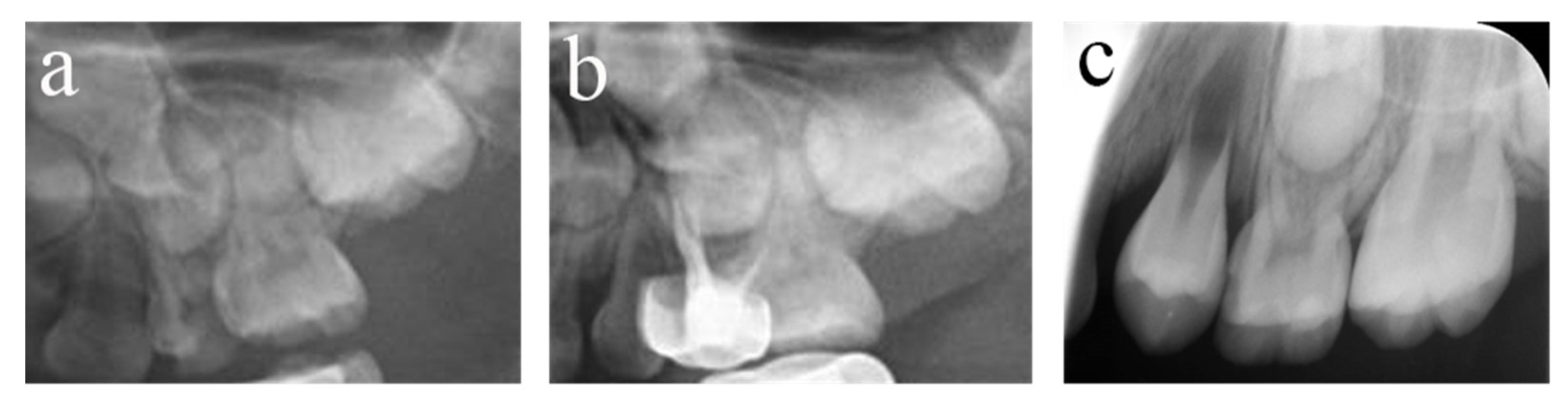 Ijerph 20 01191 g006