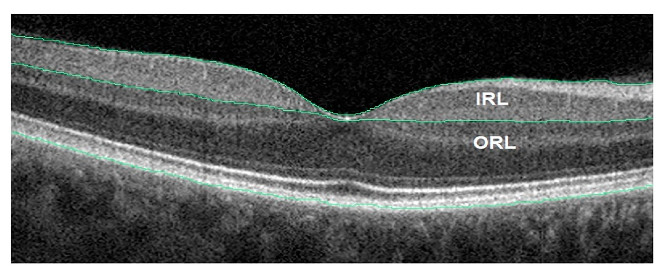 Ijerph 20 01273 g006