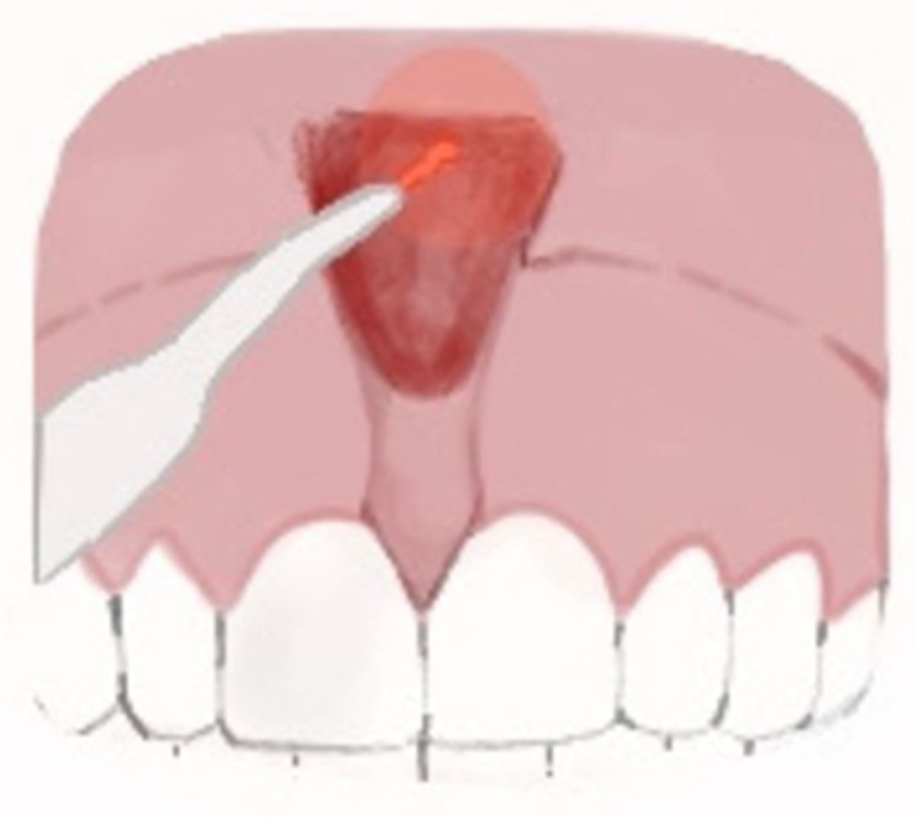 Ijerph 20 01302 g005