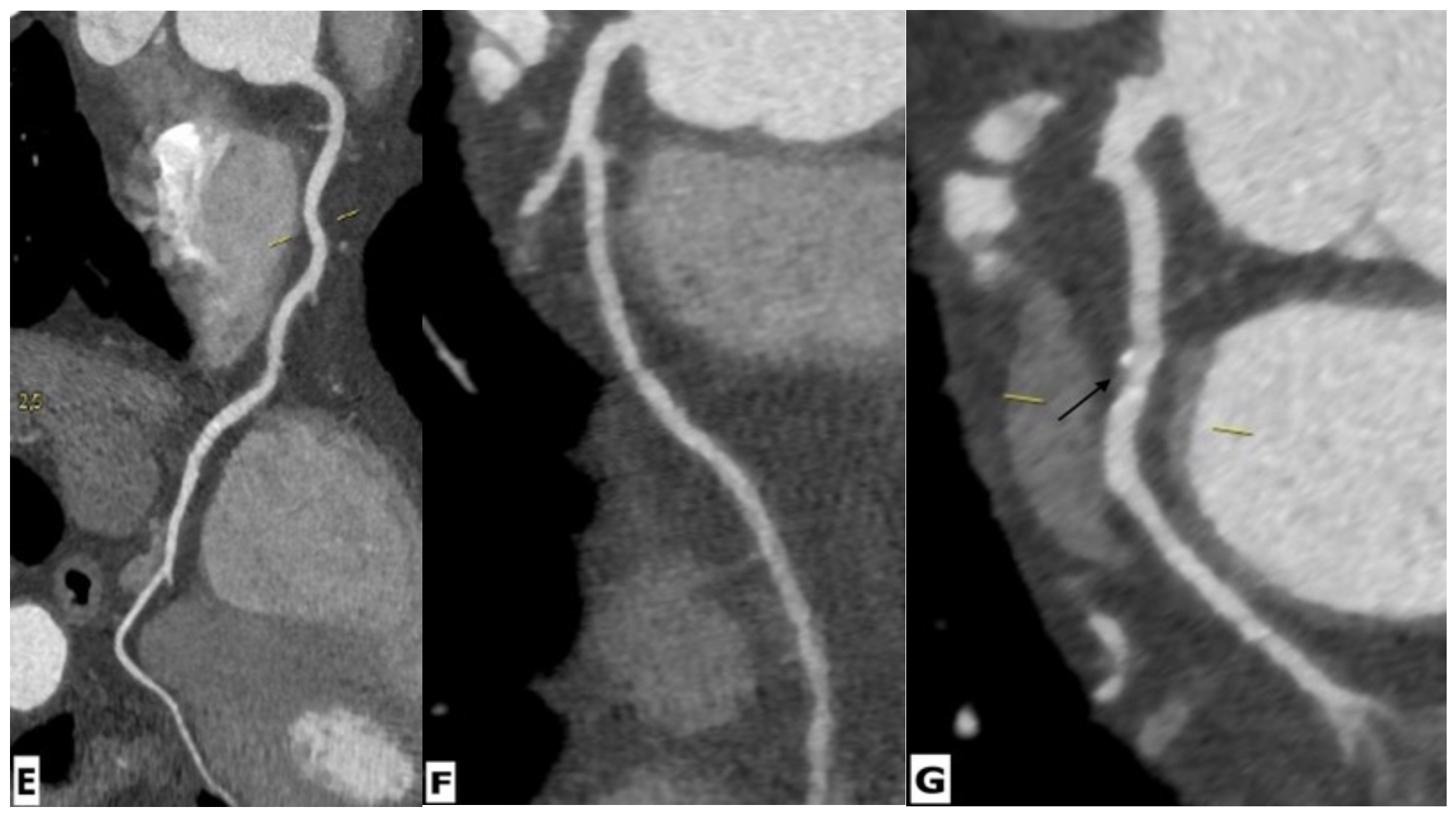 Ijerph 20 02201 g005b Ijerph 20 02201 g005b