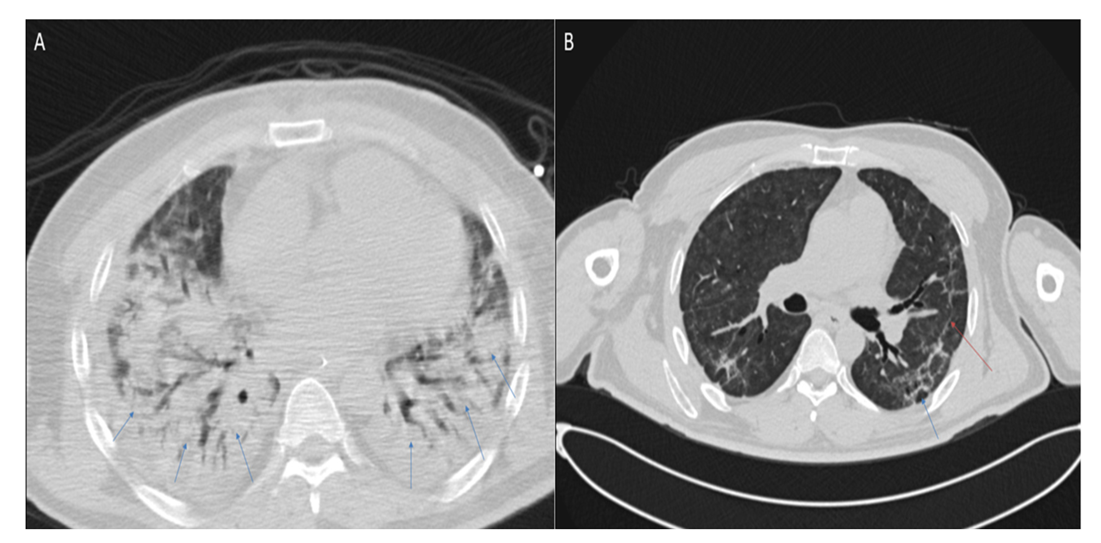 Ijerph 20 02567 g006